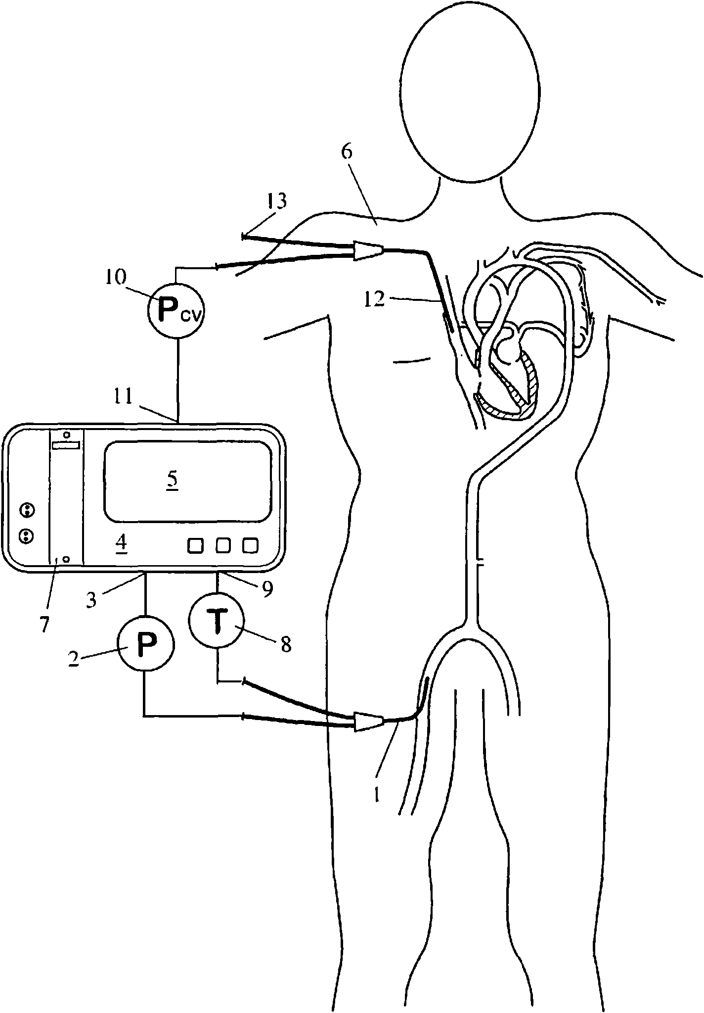 Apparatus and method for determining physiologic parameters of a patient