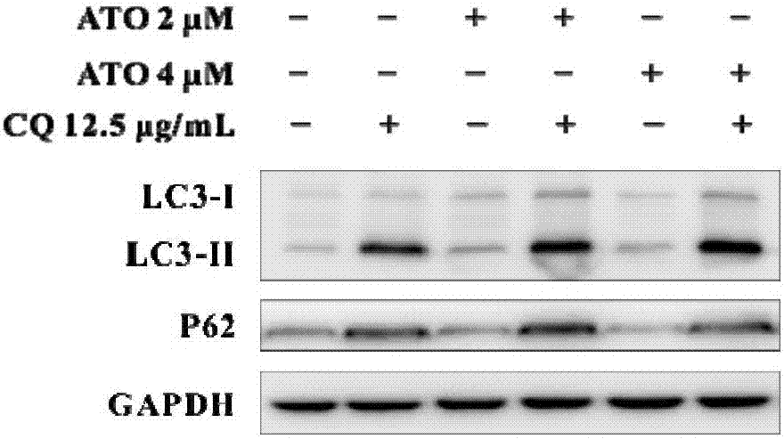 Autophagy blocking system based on nano materials, preparation method thereof and application in arsenical-drug solid-tumor treatment with same