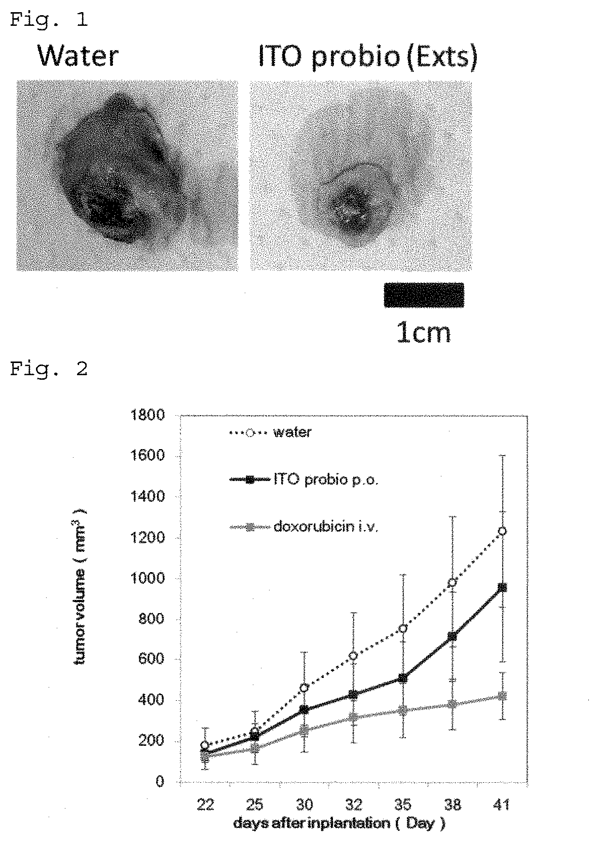 Composition for treating, preventing, ameliorating or suppressing cancer or inhibiting cancer metastasis