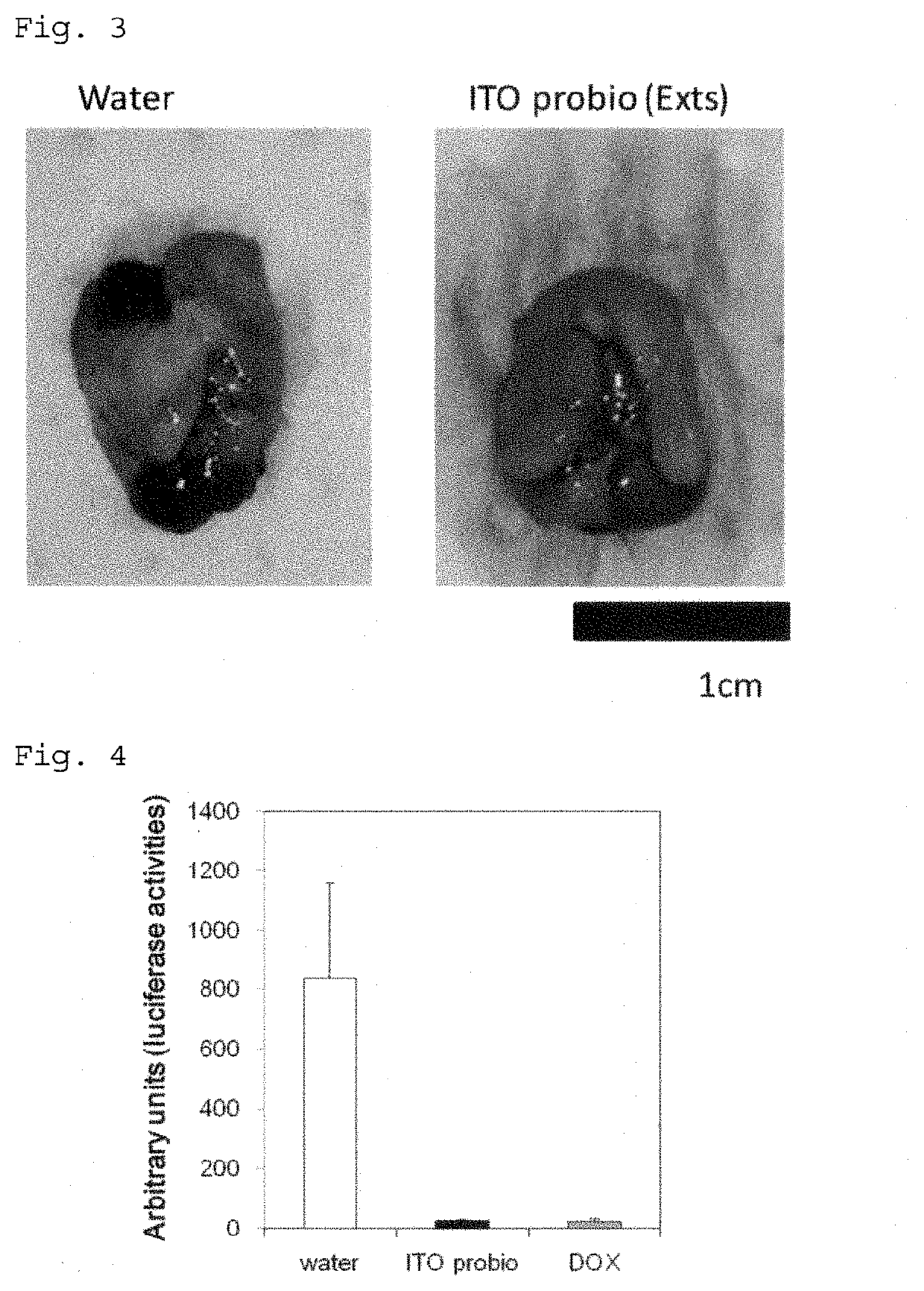 Composition for treating, preventing, ameliorating or suppressing cancer or inhibiting cancer metastasis