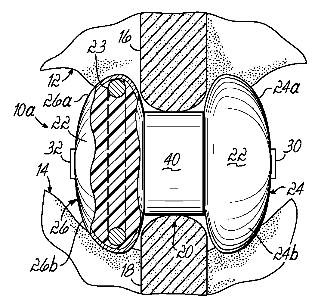 Expandable interspinous process spacer with lateral support and method for implantation