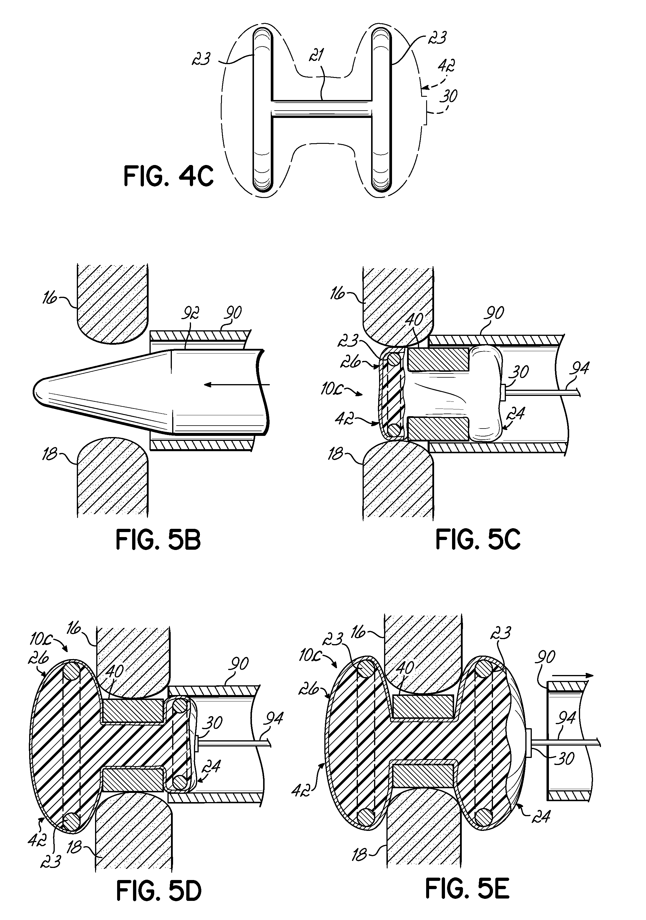 Expandable interspinous process spacer with lateral support and method for implantation