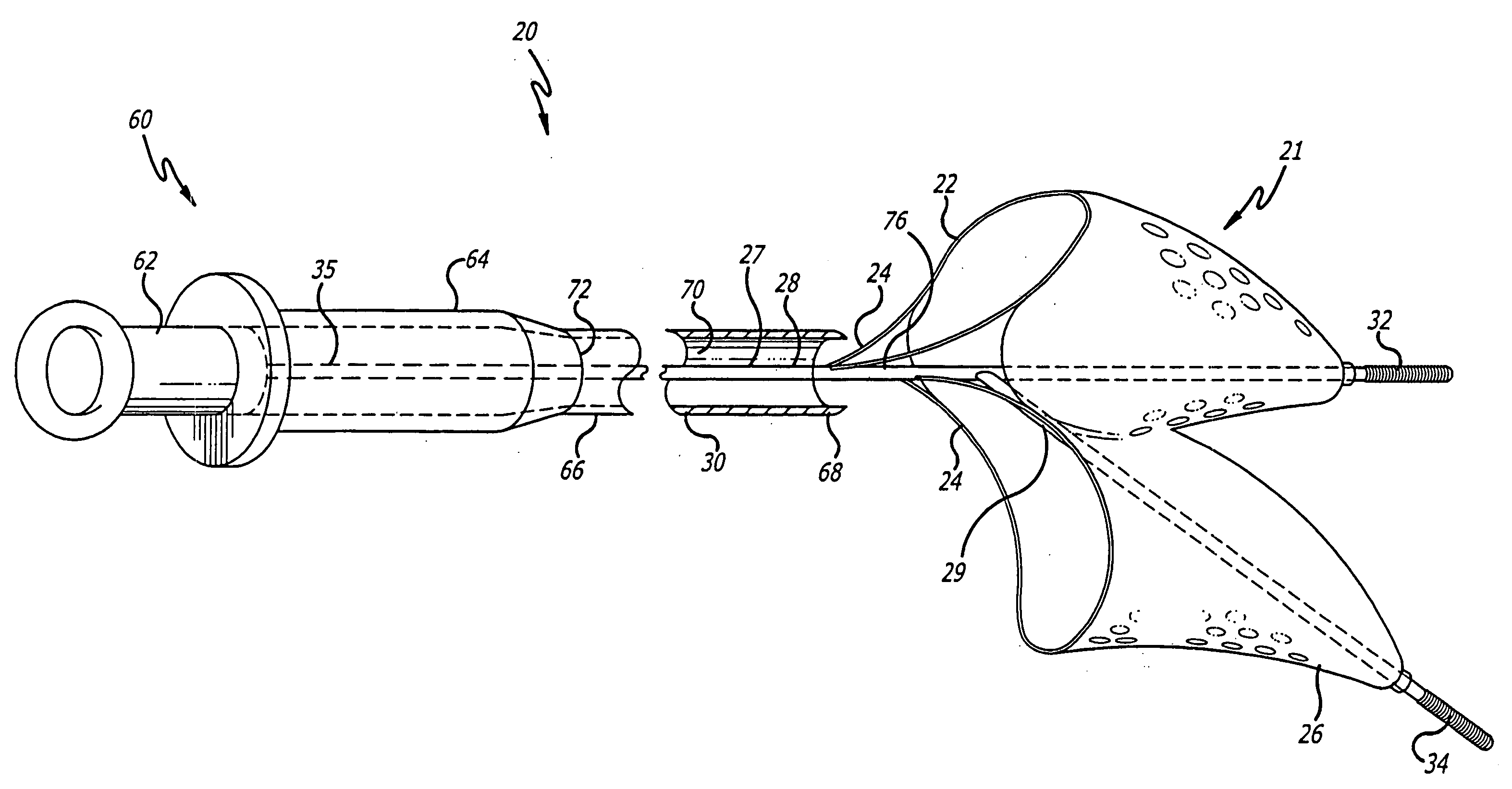 Embolic filtering devices for bifurcated vessels