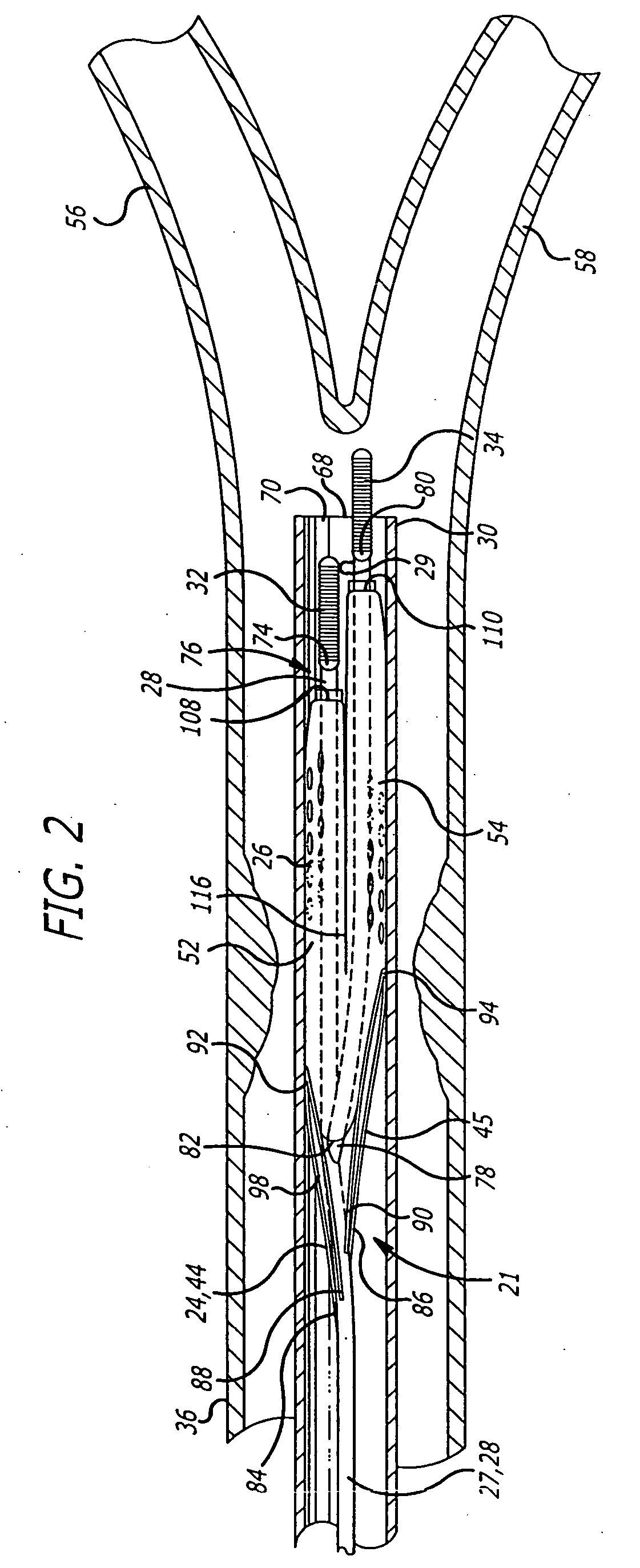Embolic filtering devices for bifurcated vessels