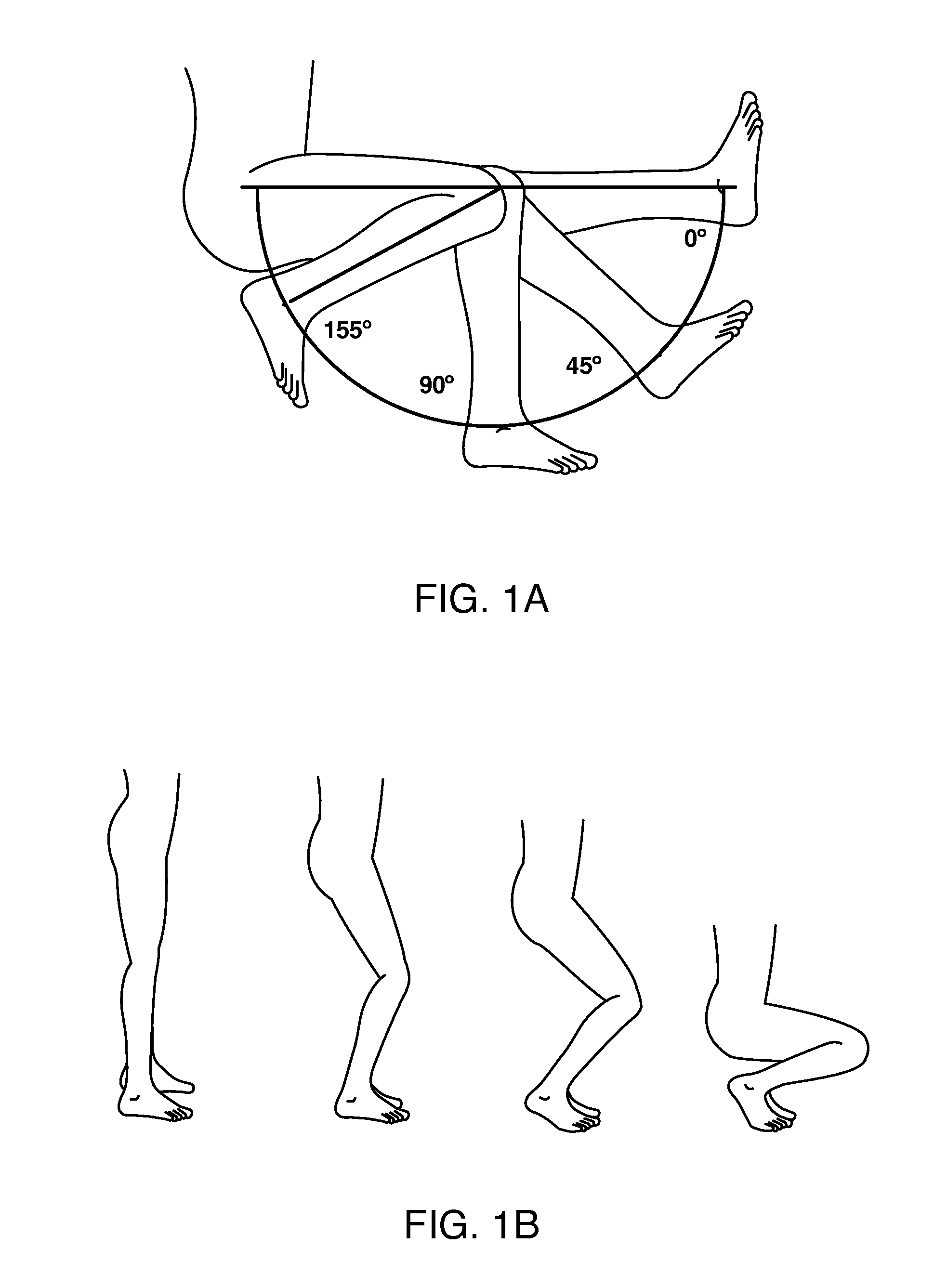 Systems and methods for providing an asymmetrical femoral component