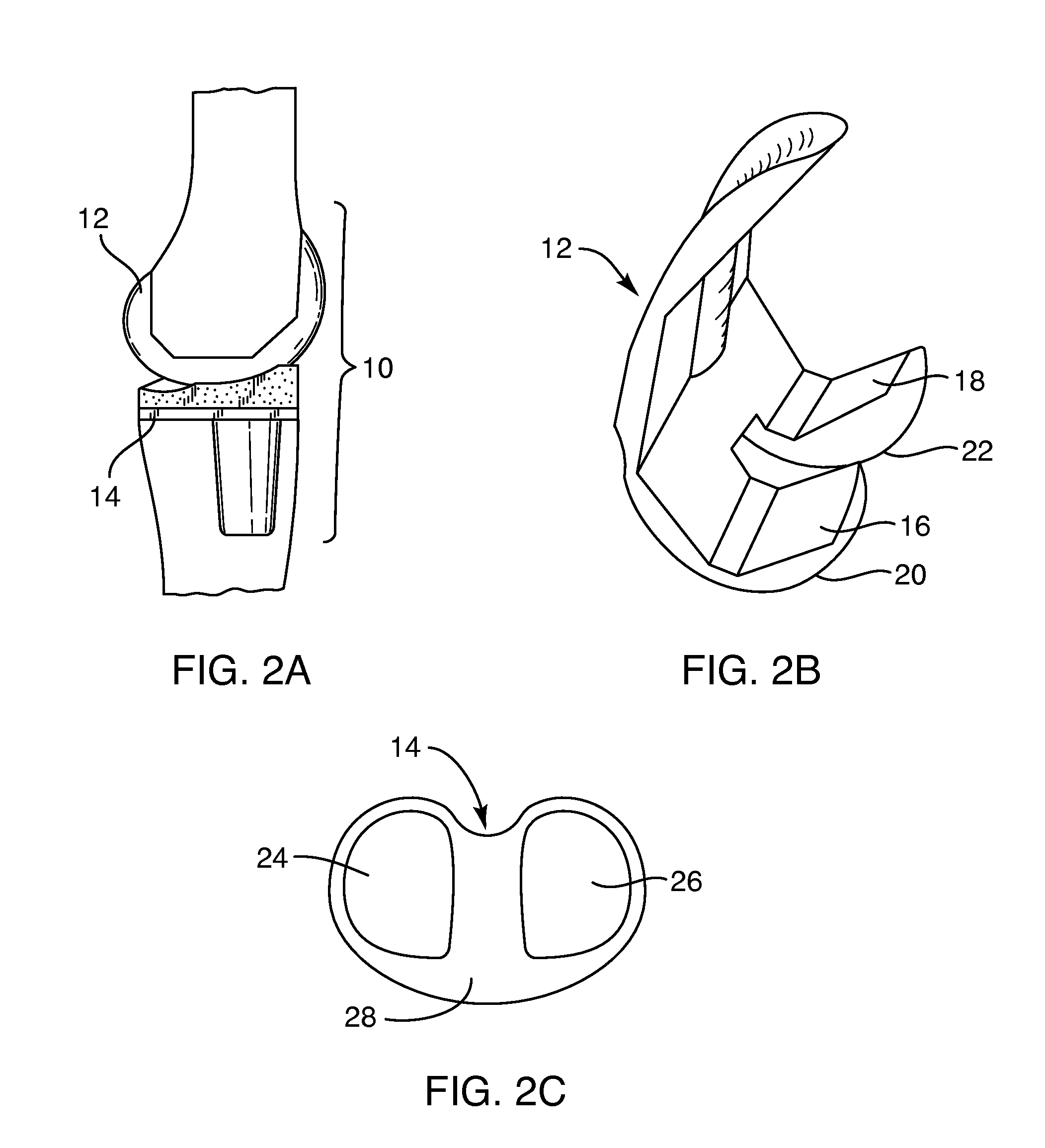 Systems and methods for providing an asymmetrical femoral component