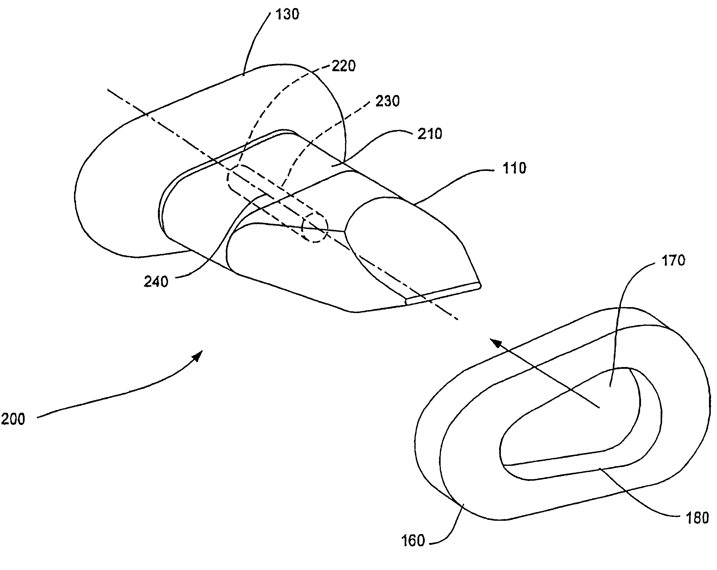 Interspinous process distraction implant and method of implantation