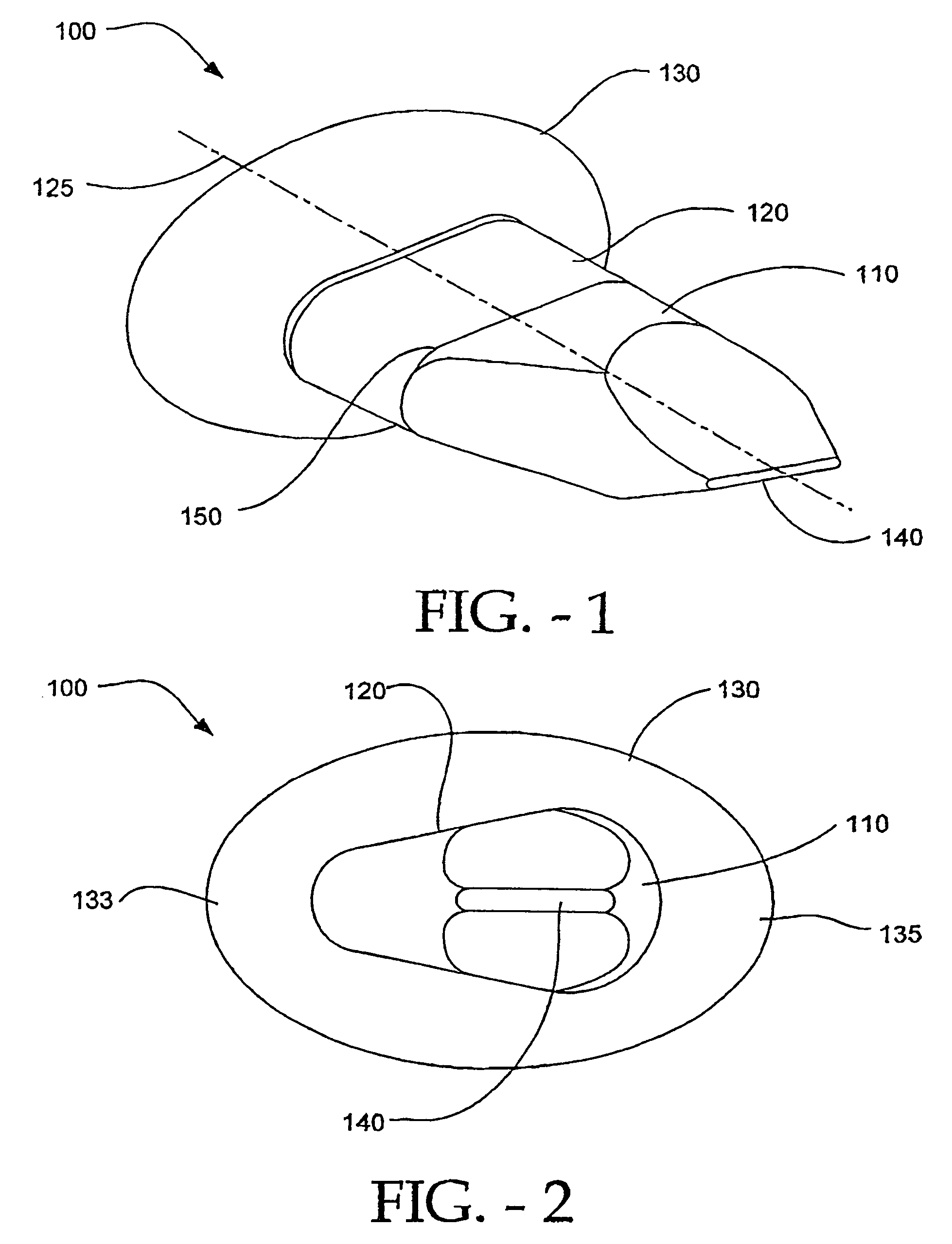 Interspinous process distraction implant and method of implantation