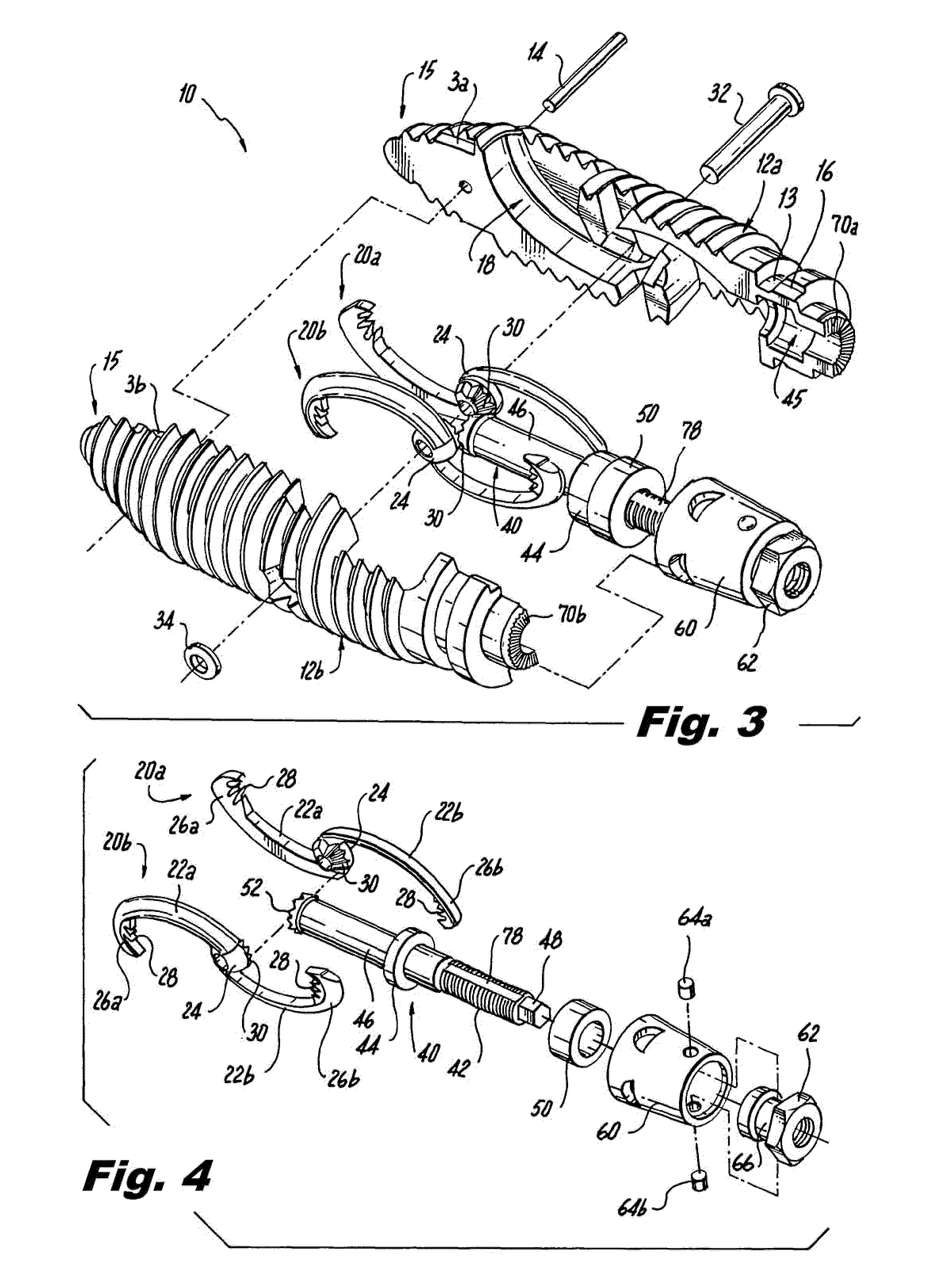 Interspinous process implants having deployable engagement arms