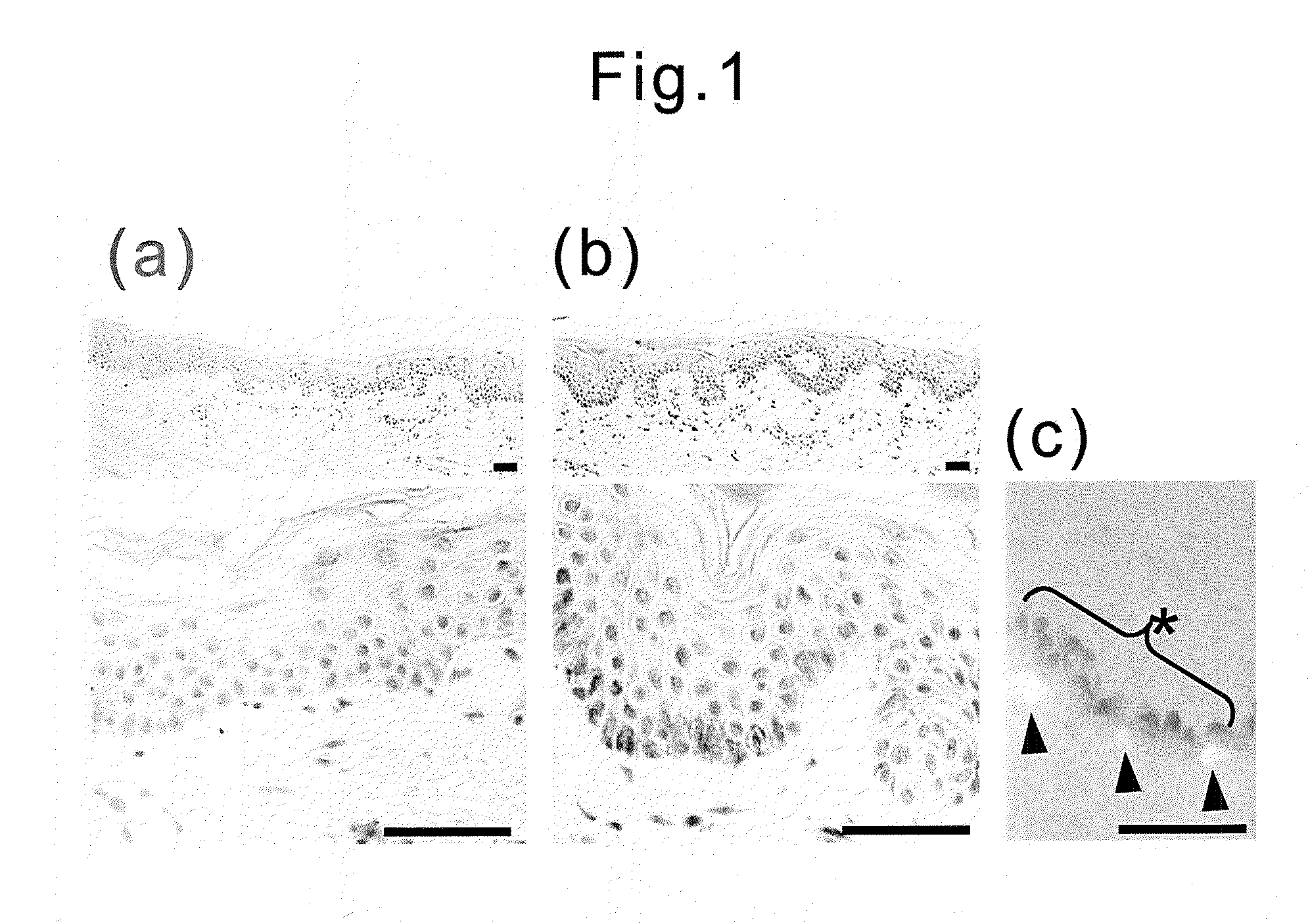 Methods of skin whitening and of screening skin-spot-formation inhibiting and/or skin-spot removing factor