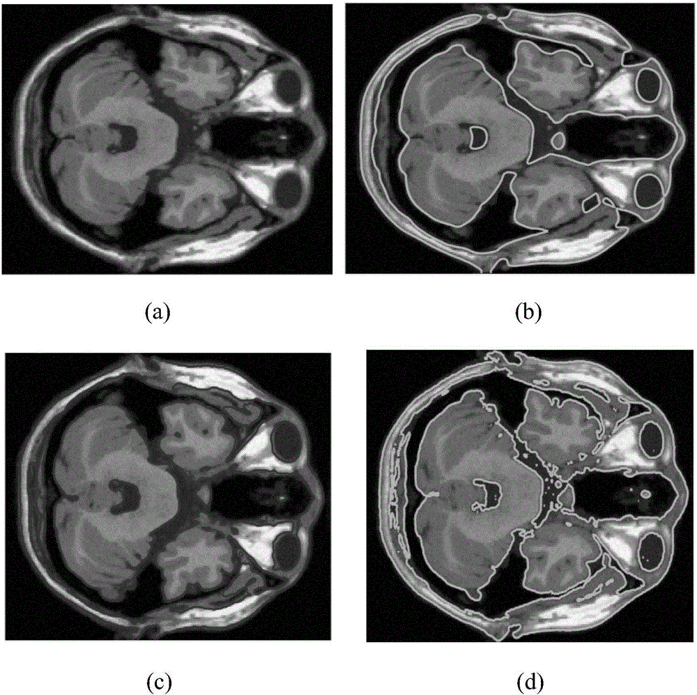 MRI (Magnetic Resonance Imaging) image segmentation method based on fuzzy thought and level set frame