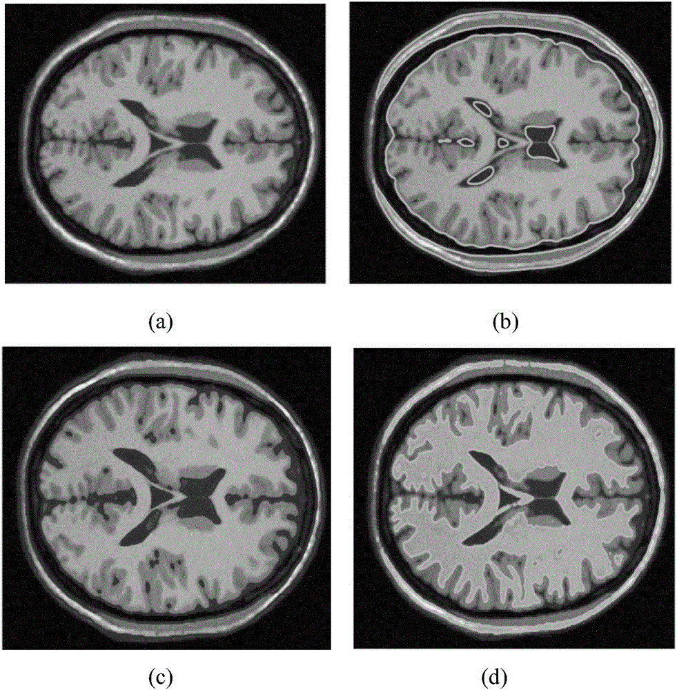 MRI (Magnetic Resonance Imaging) image segmentation method based on fuzzy thought and level set frame