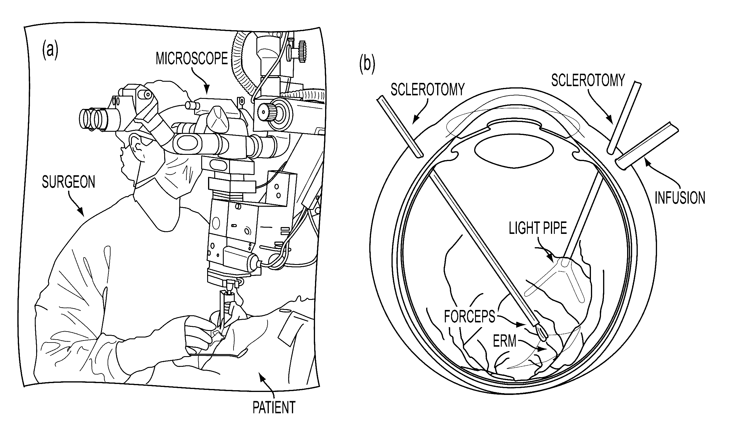Multi-force sensing surgical instrument and method of use for robotic surgical systems