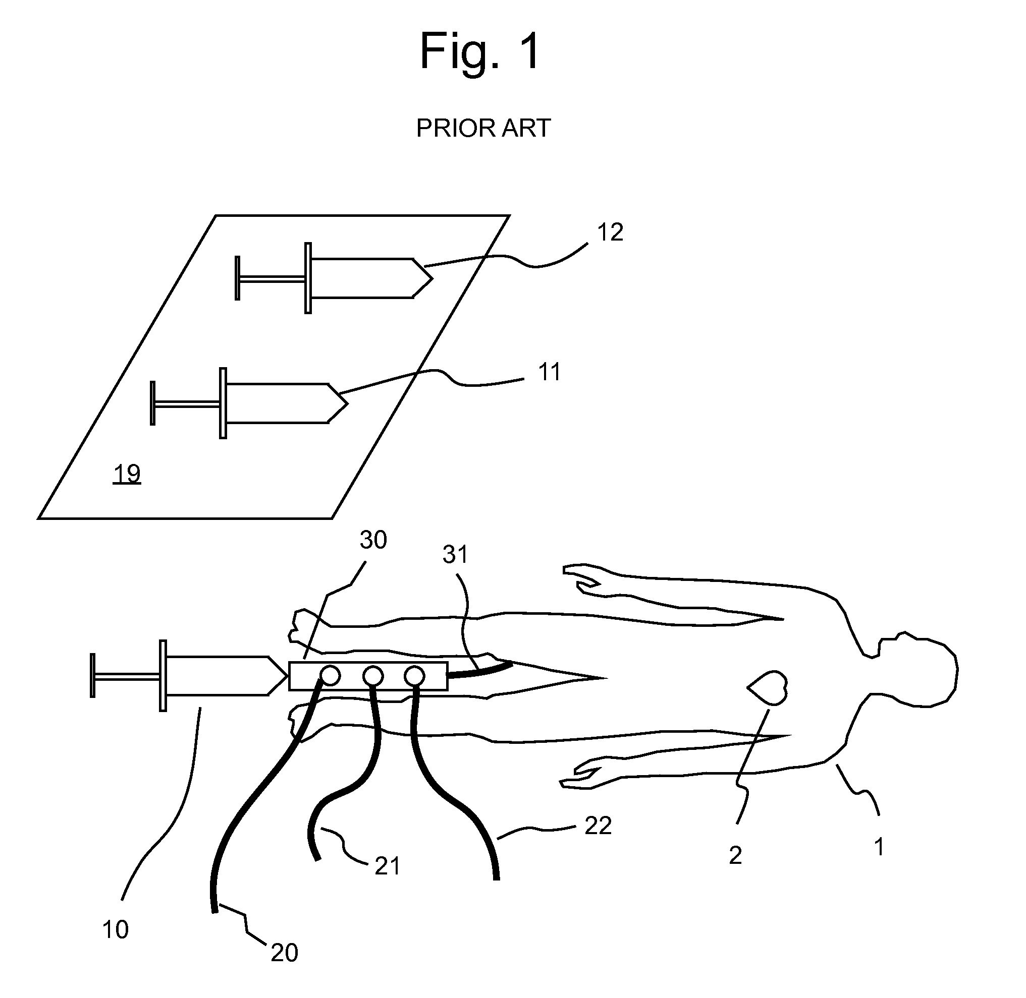 Fluid delivery systems, devices and methods for delivery of hazardous fluids
