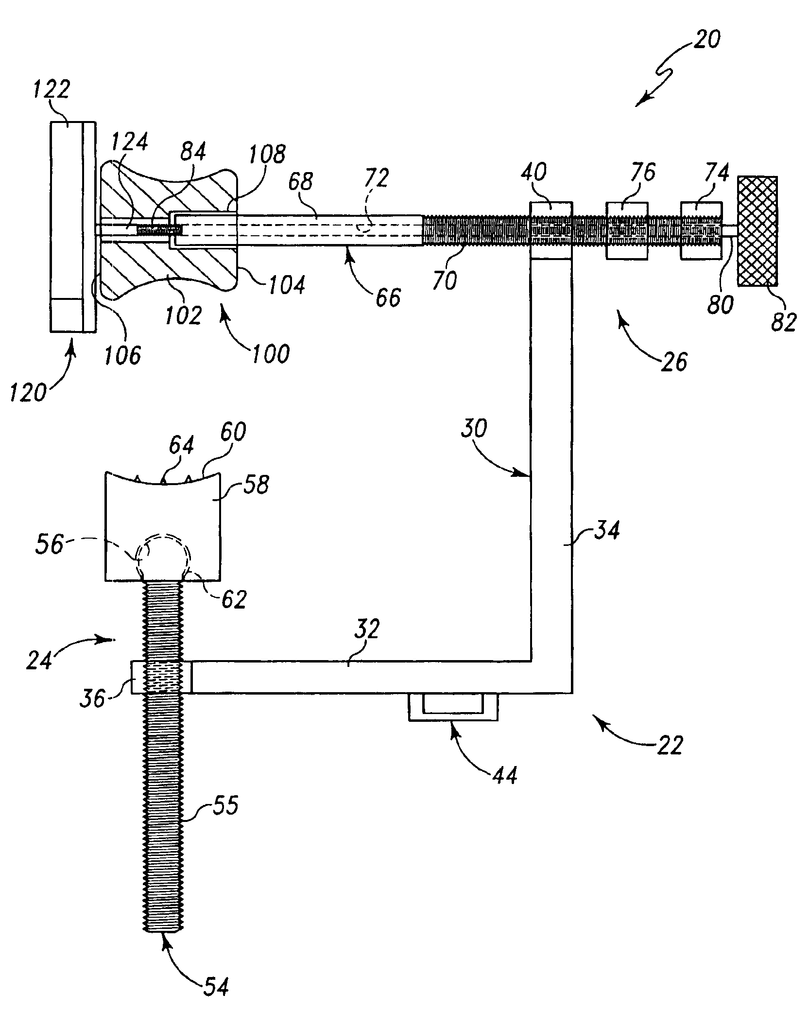 Method and apparatus for resecting bone from an ulna in preparation for prosthetic implantation