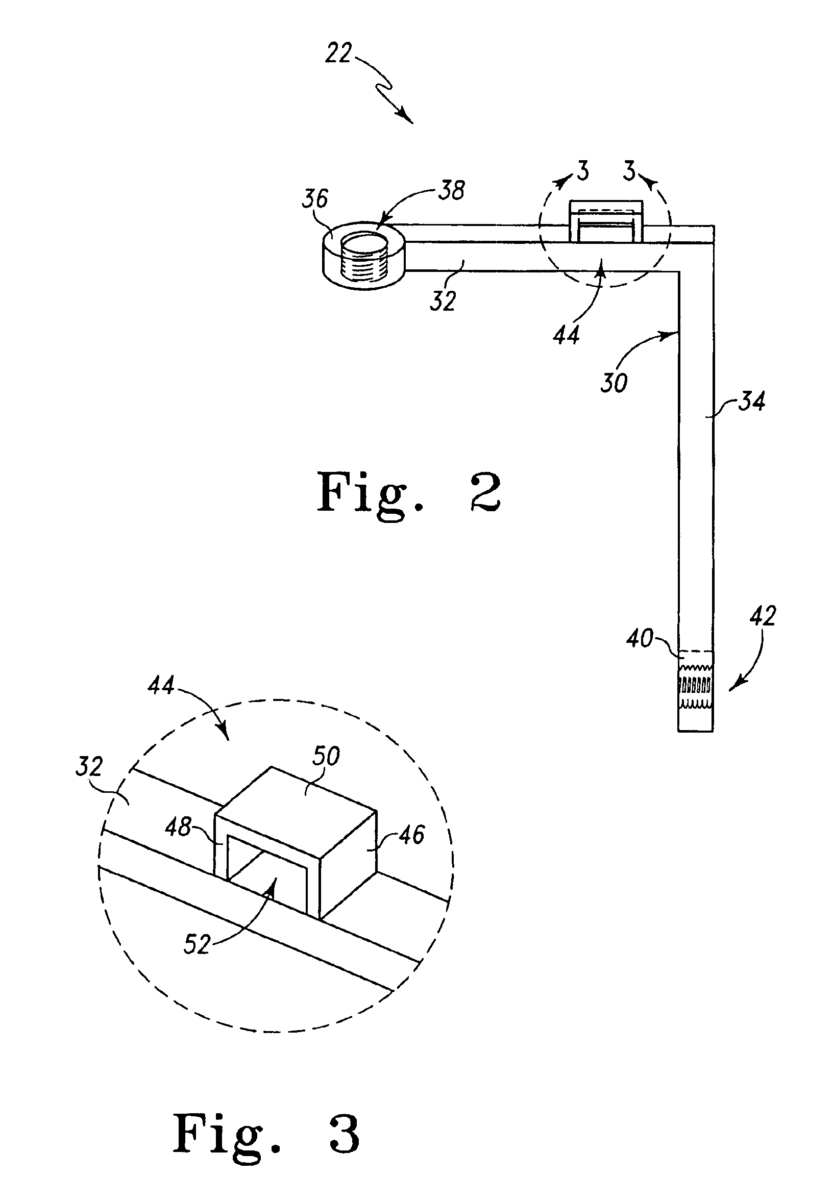Method and apparatus for resecting bone from an ulna in preparation for prosthetic implantation