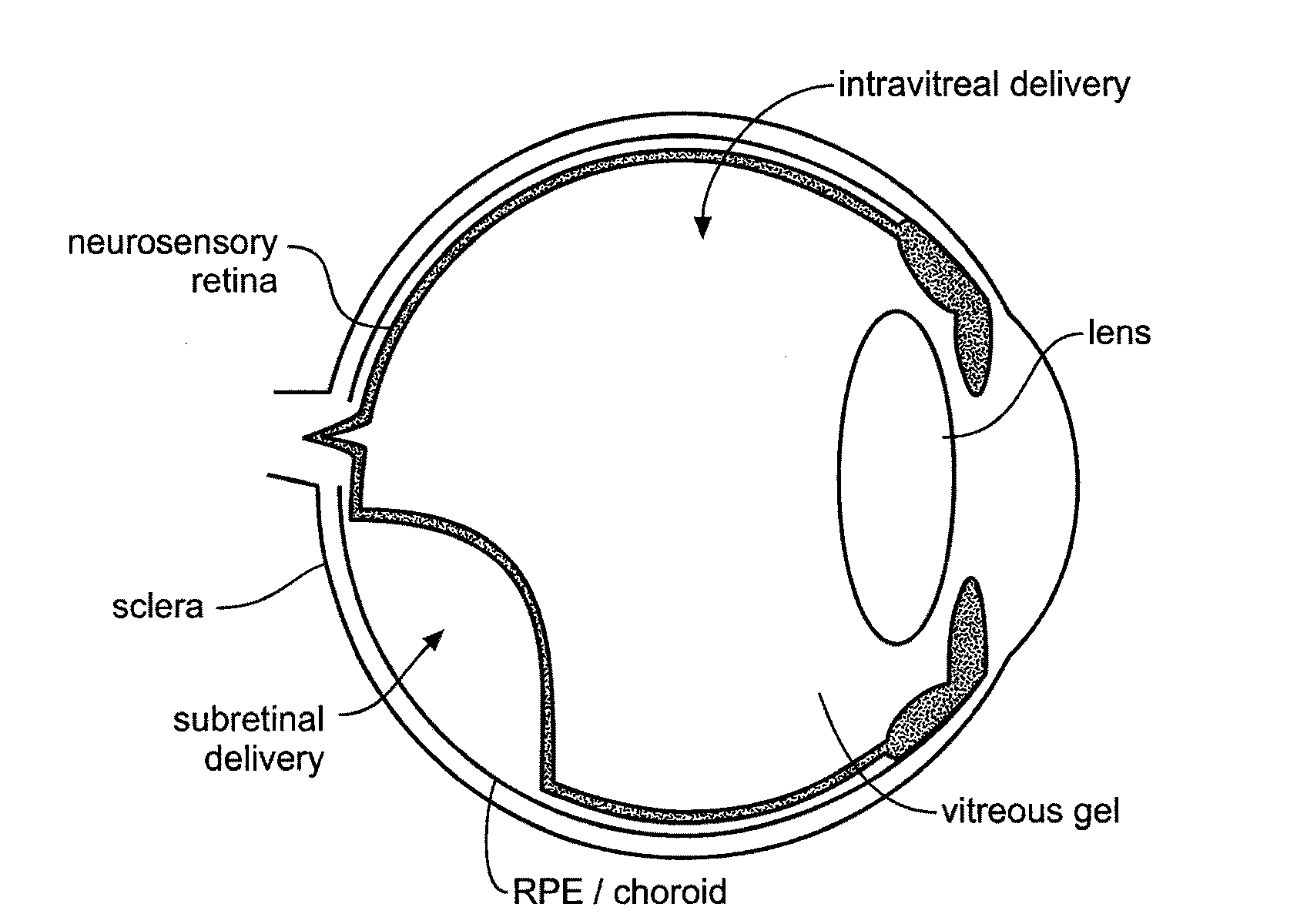 Devices and methods for delivering polynucleotides into retinal cells of the macula and fovea