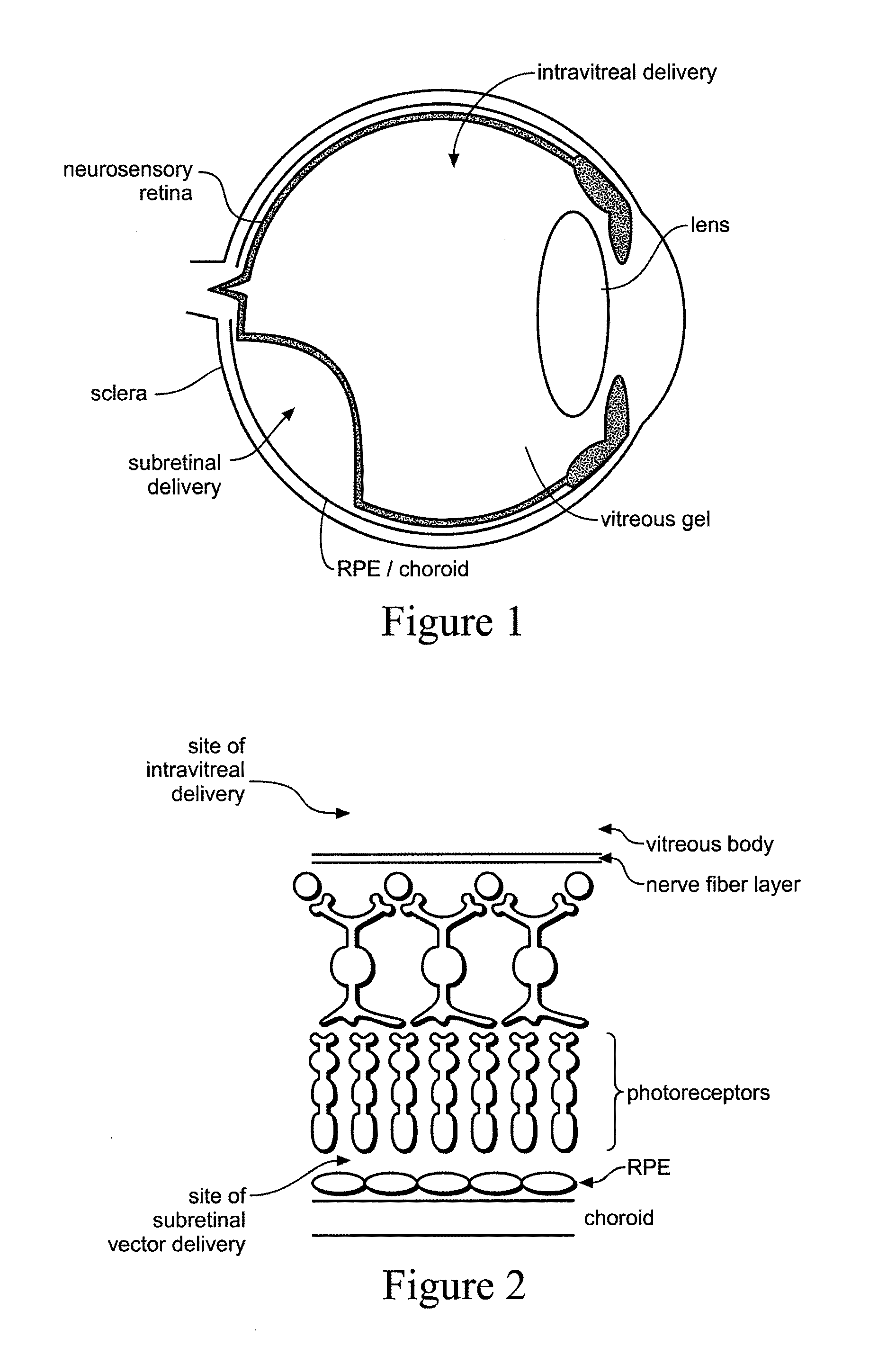 Devices and methods for delivering polynucleotides into retinal cells of the macula and fovea