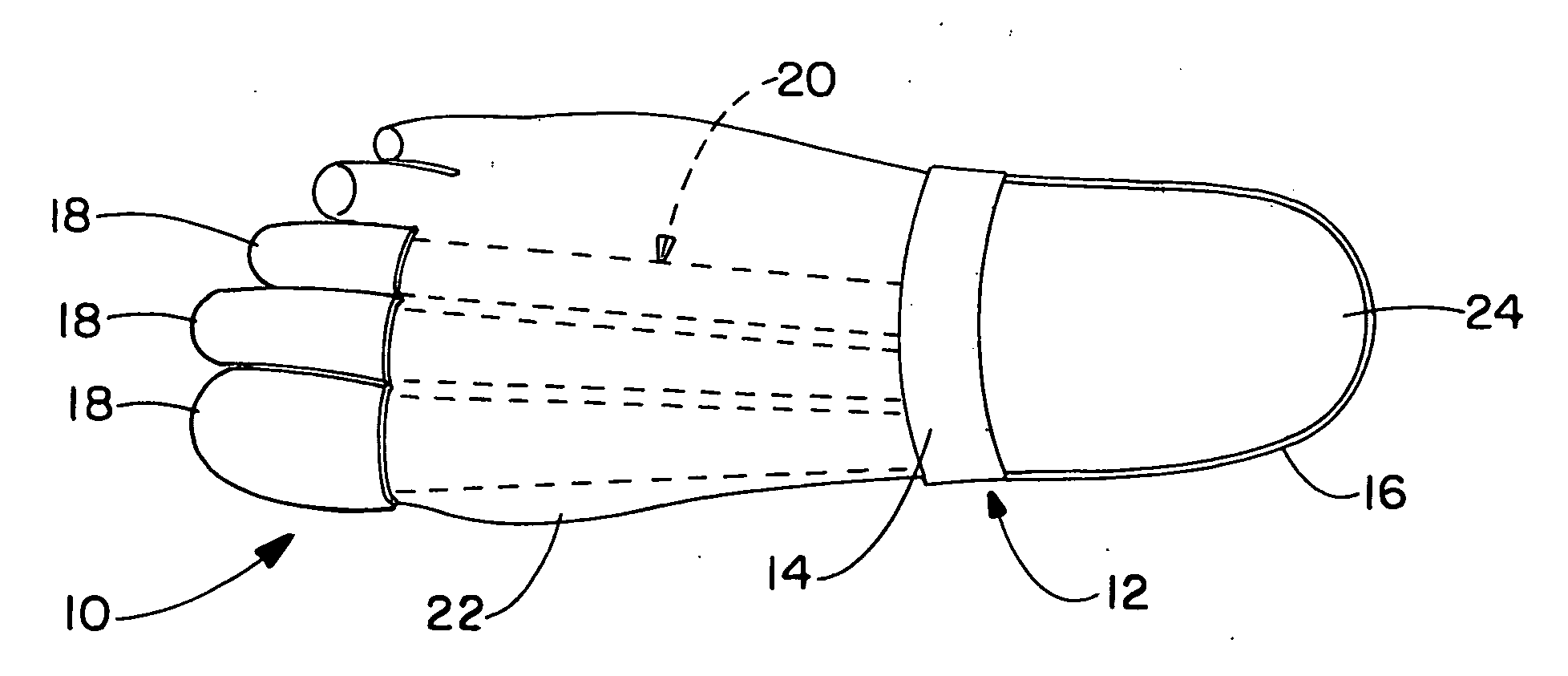 Therapeutic foot appliance and method of use