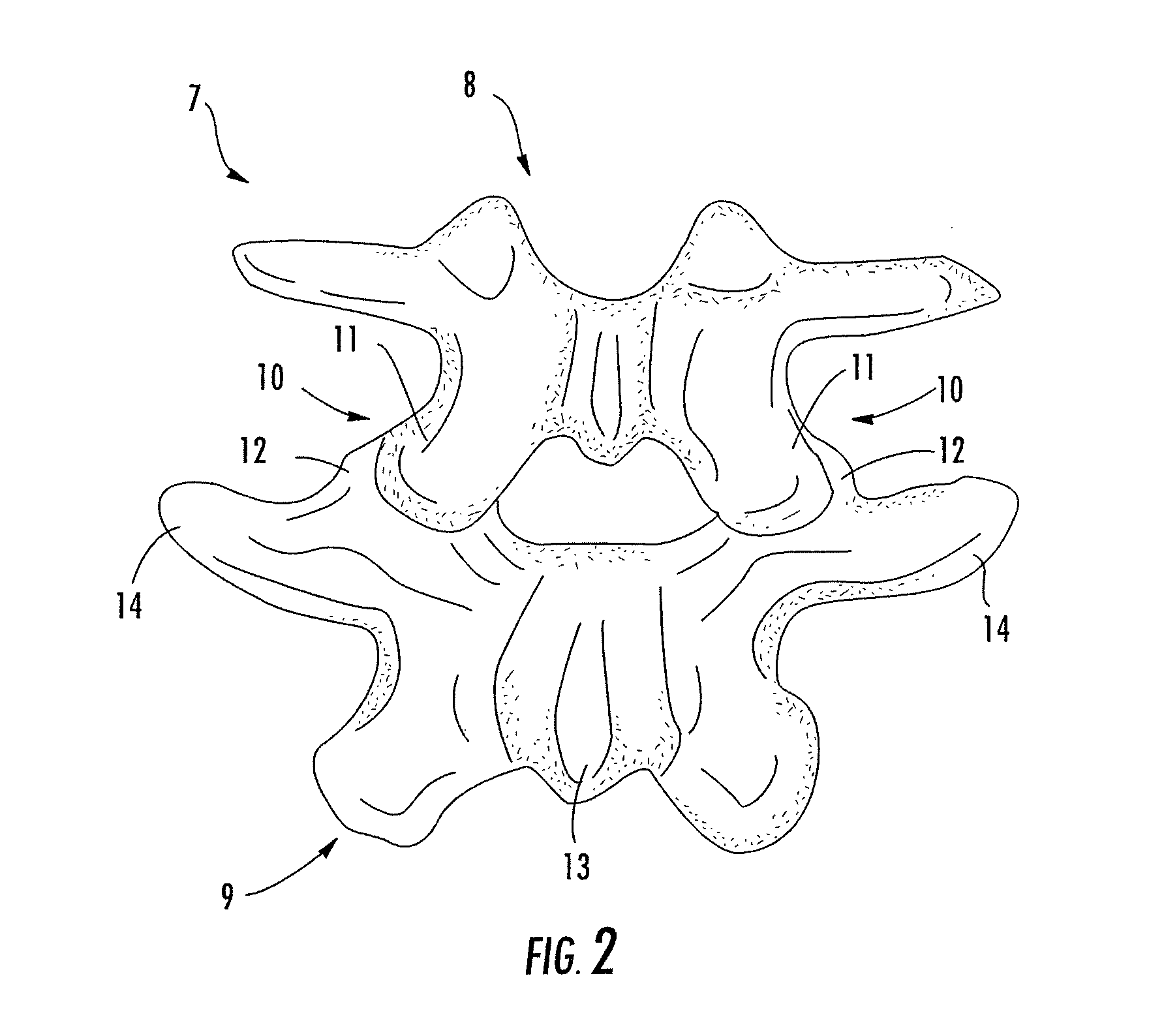 Connecting rod for bone anchors having a bioresorbable tip