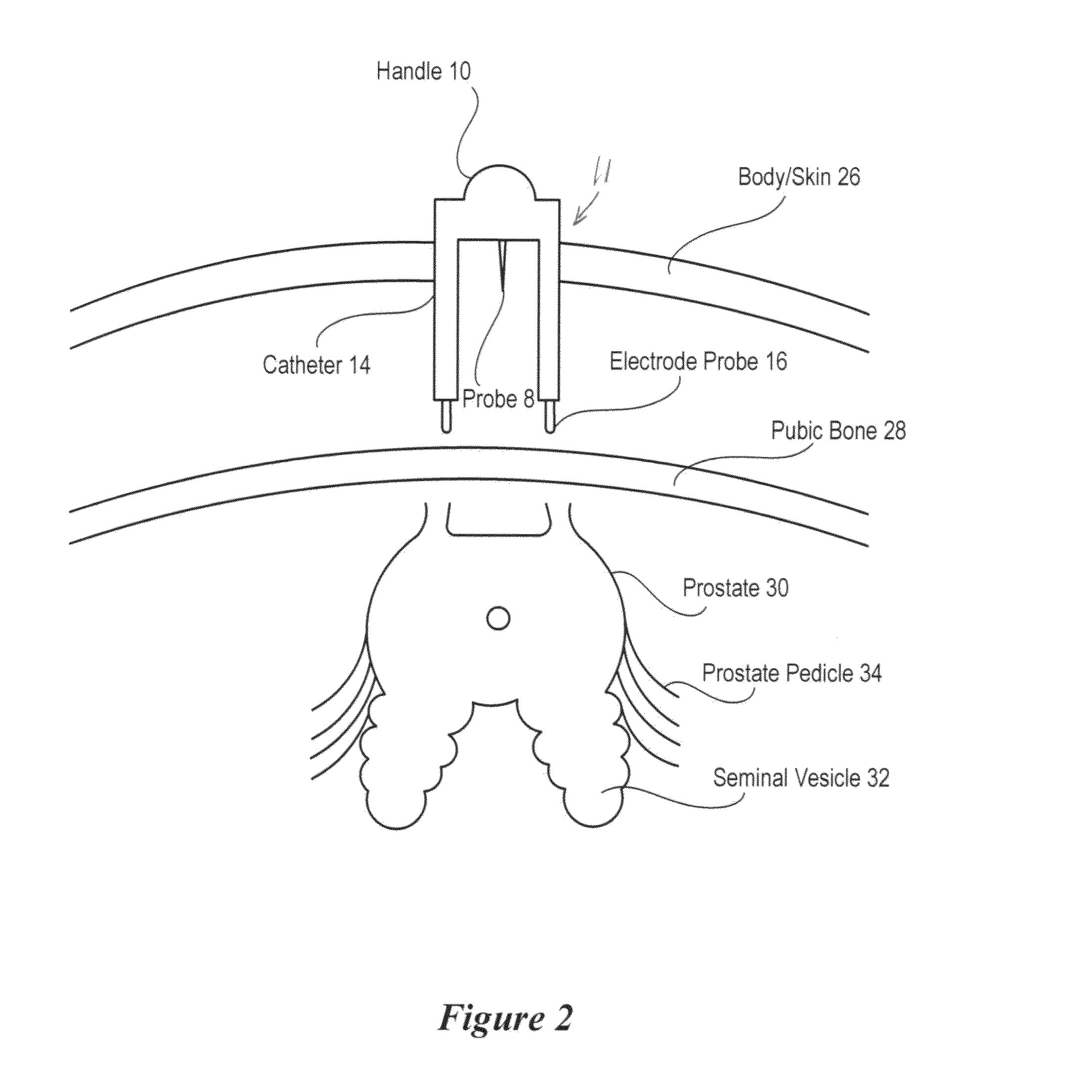 Nerve Mapping Surgical System and Method of Use of Dual Function Surgical Instrument Within Such System