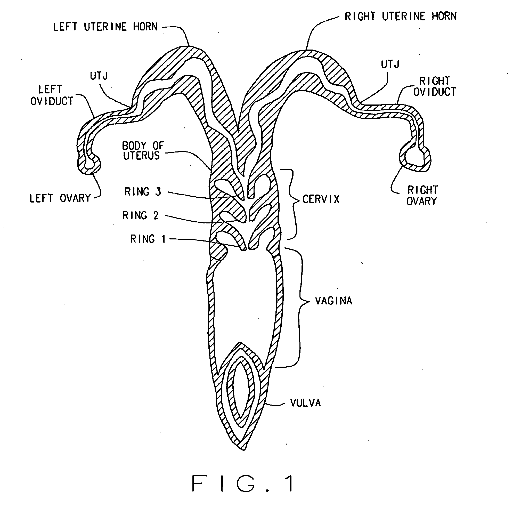 Artificial breeding techniques for bovines including semen diluents and ai apparatus