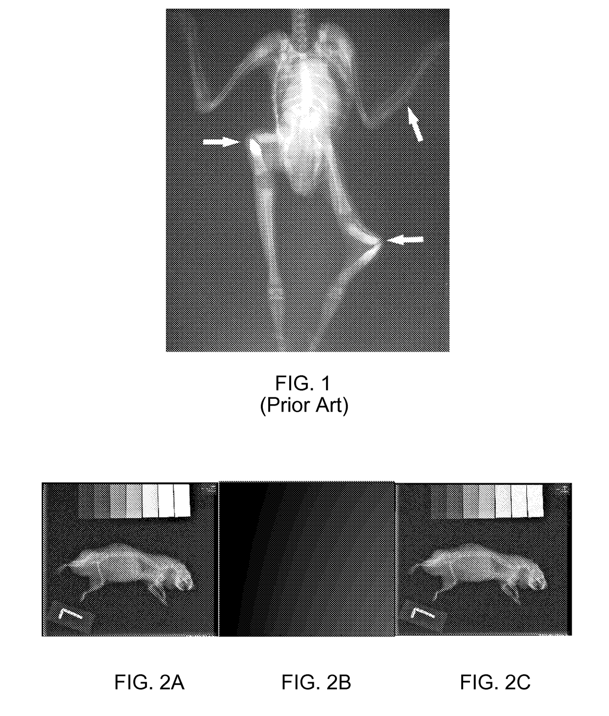 Radiograph density detection device