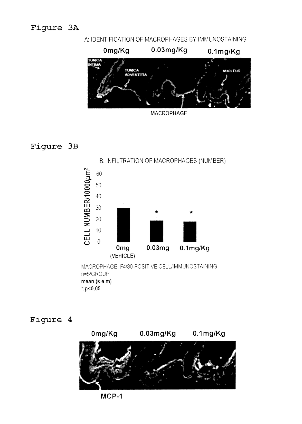 Medicinal composition for inhibiting formation and/or enlargement of cerebral aneurysm or shrinking same