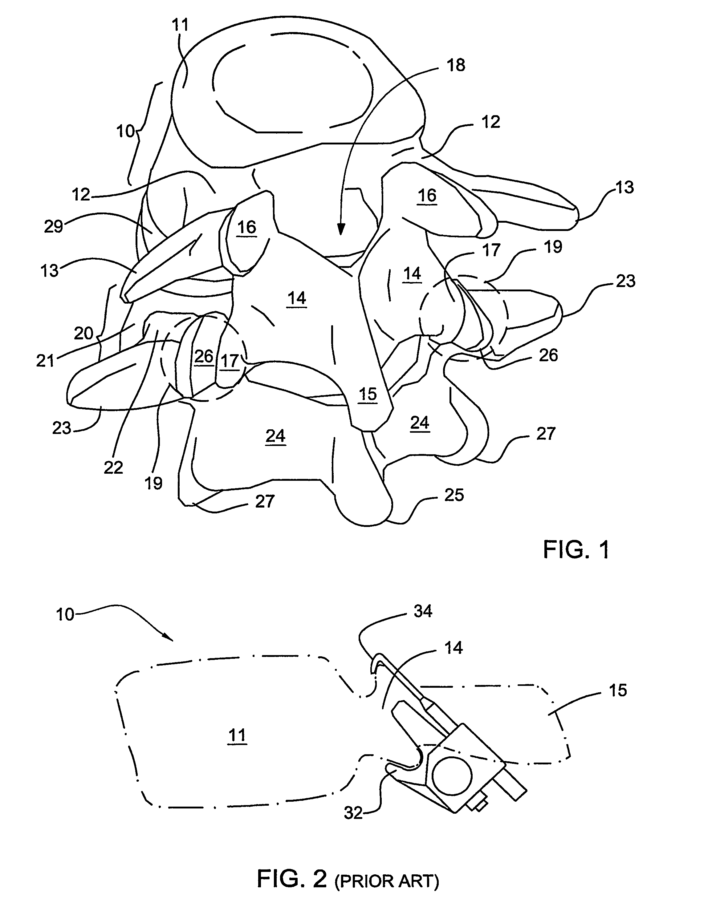 Orthopedic clamps