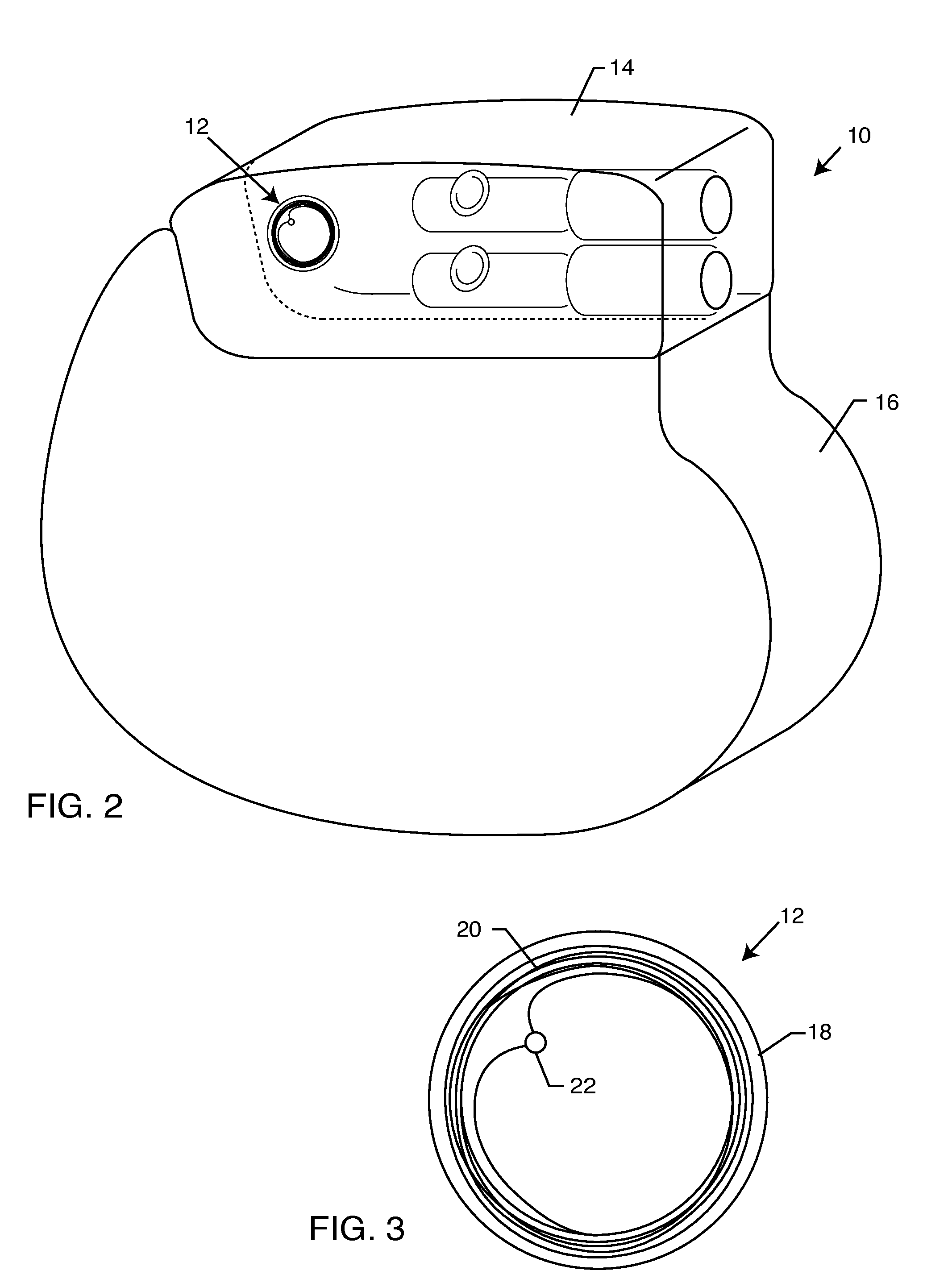 Process for transferring product information utilizing barcode reader into permanent memory for an implanted medical device