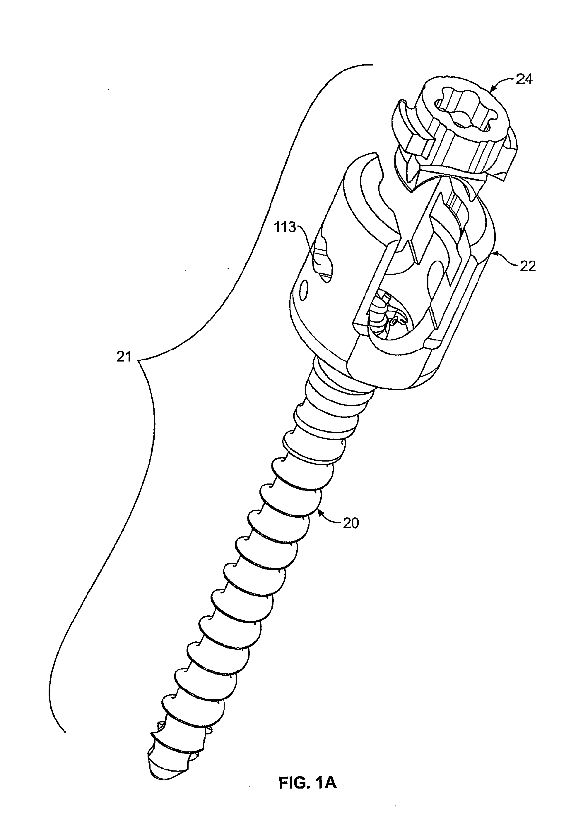 Minimally Invasive Surgical System