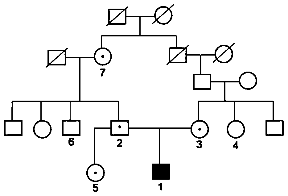 Mutant of CAII and application thereof