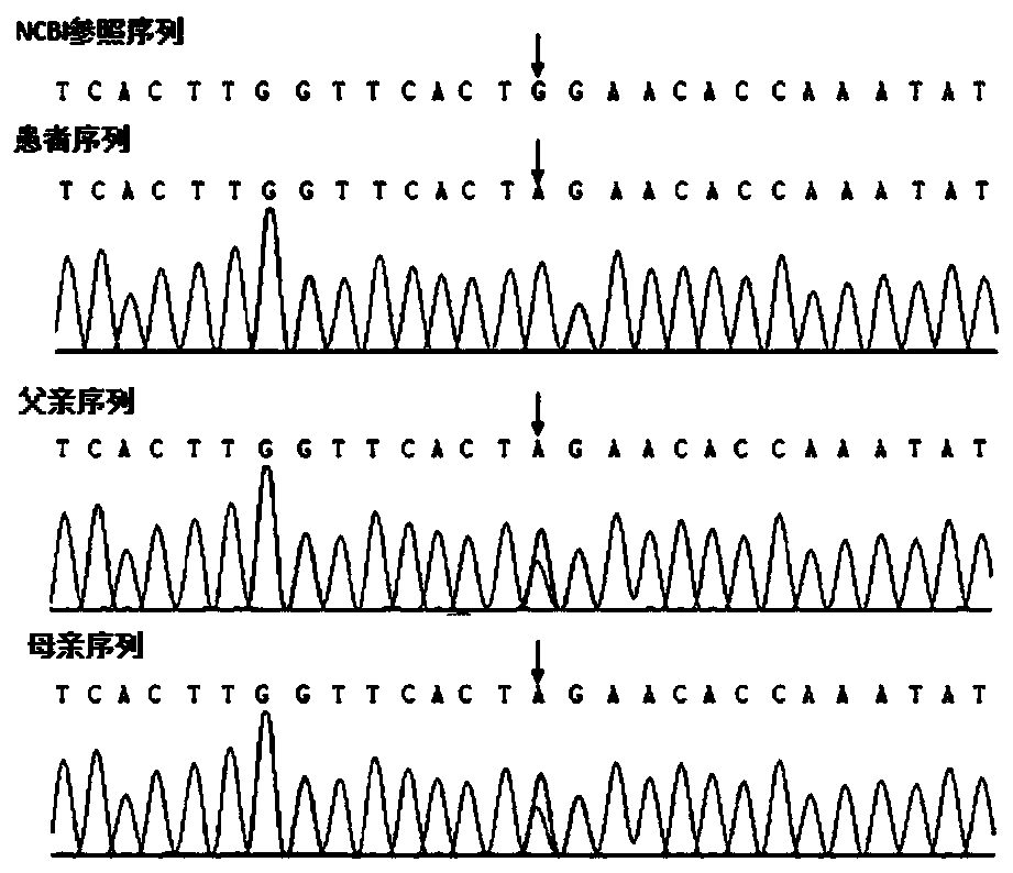 Mutant of CAII and application thereof