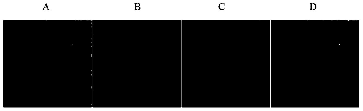 Method for preparing sPD1-loaded microbubbles targeting CD133 and application thereof in preparing drugs for inhibiting cervical cancer