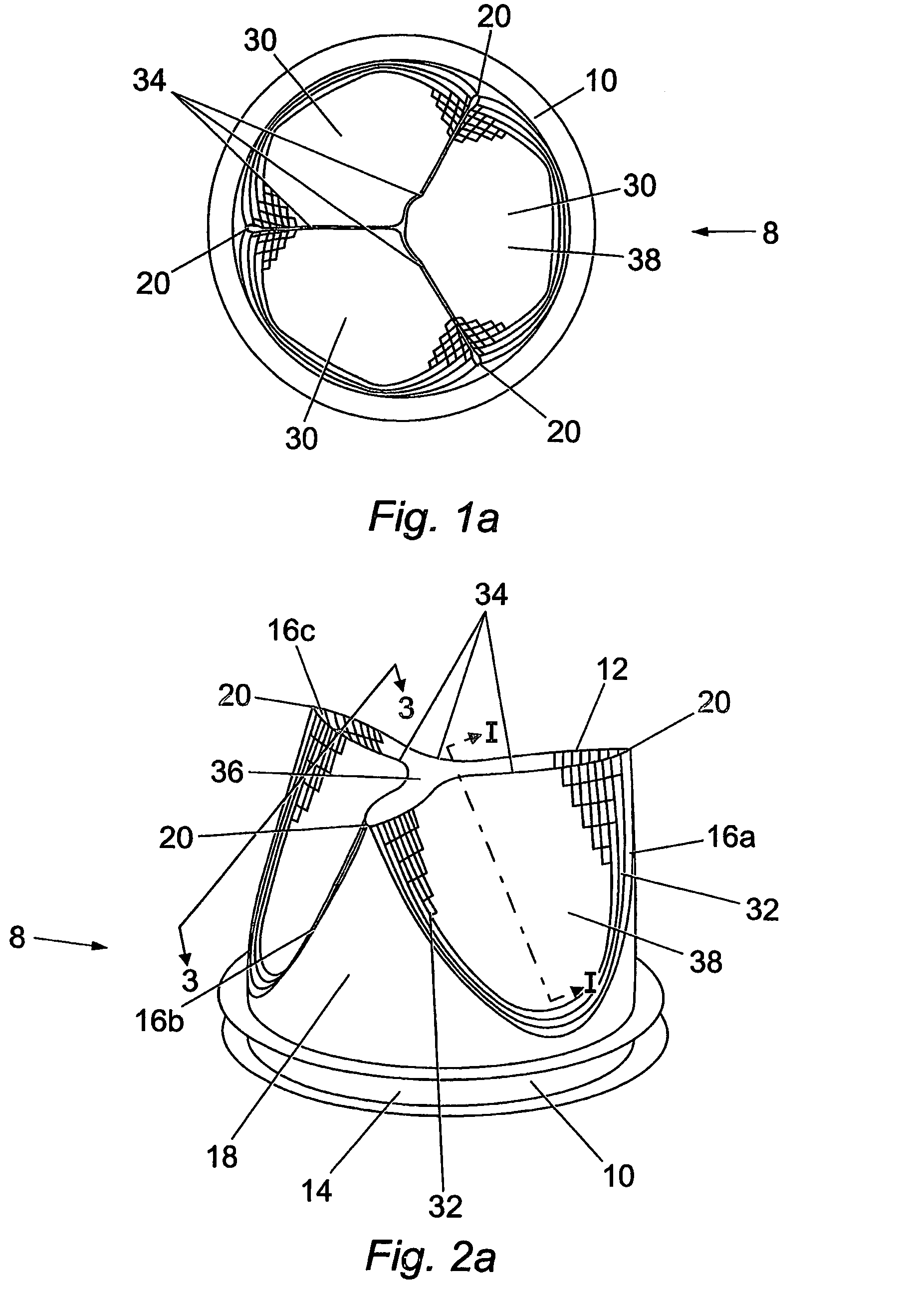Cardiac valve featuring a parabolic function