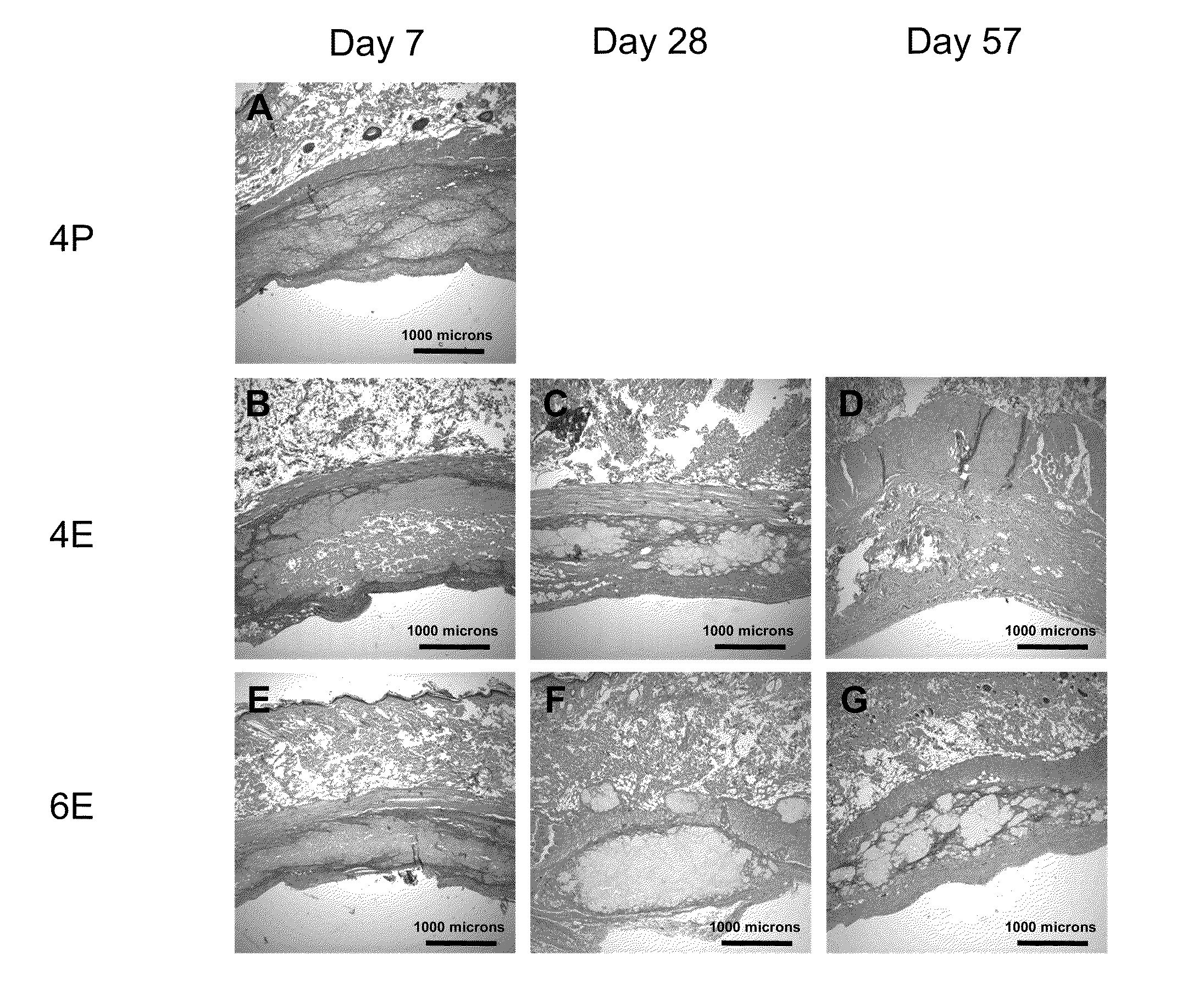 Silk Fibroin Hydrogels and Uses Thereof