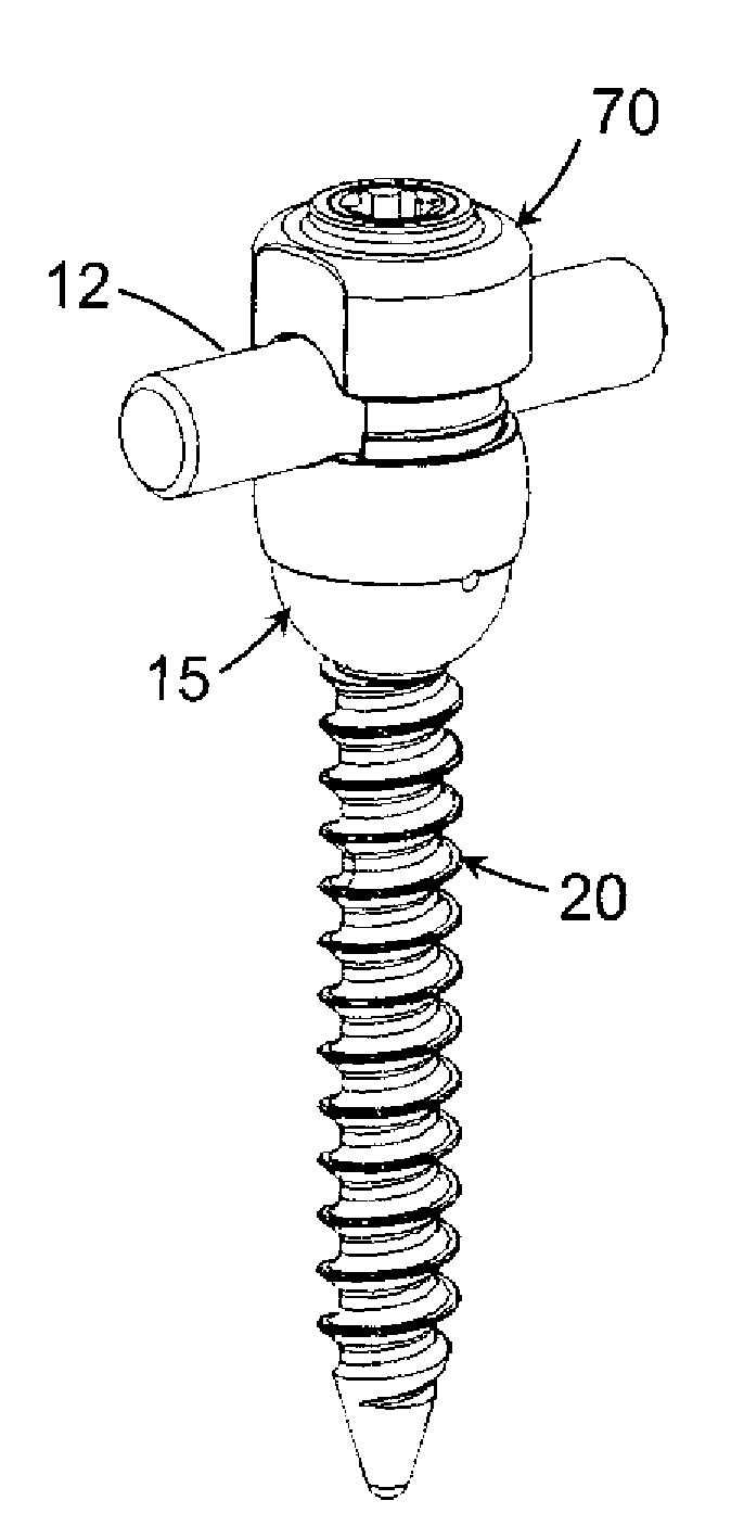 Multi-Axial Spinal Fixation System