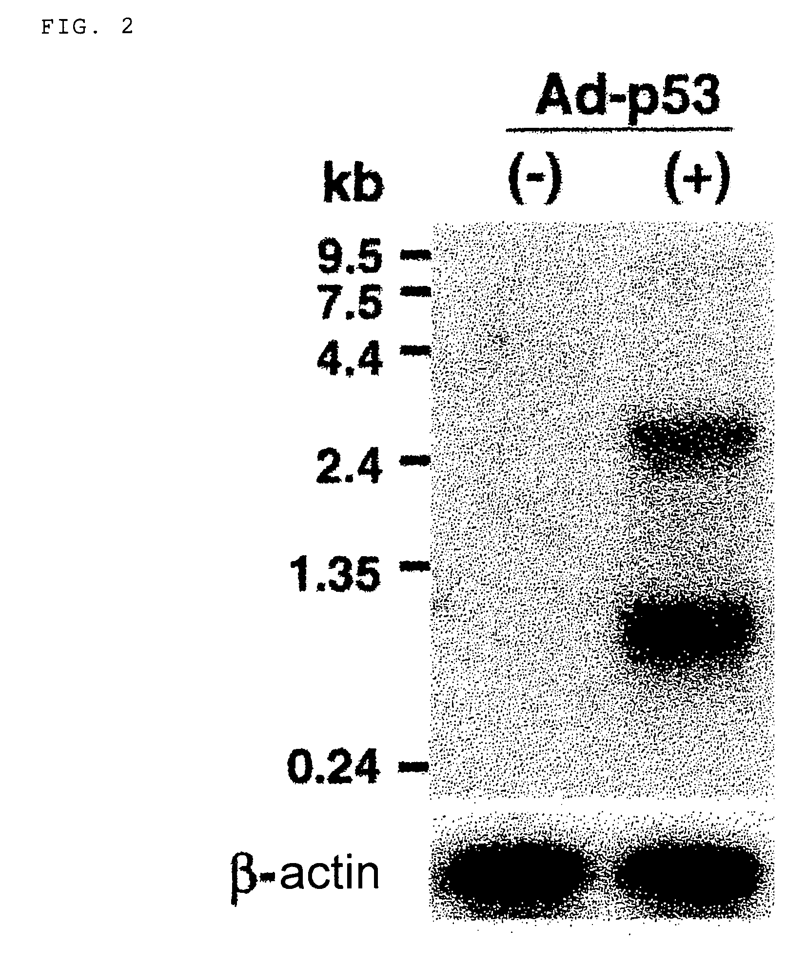 P53 dependent apoptosis-associated gene and protein
