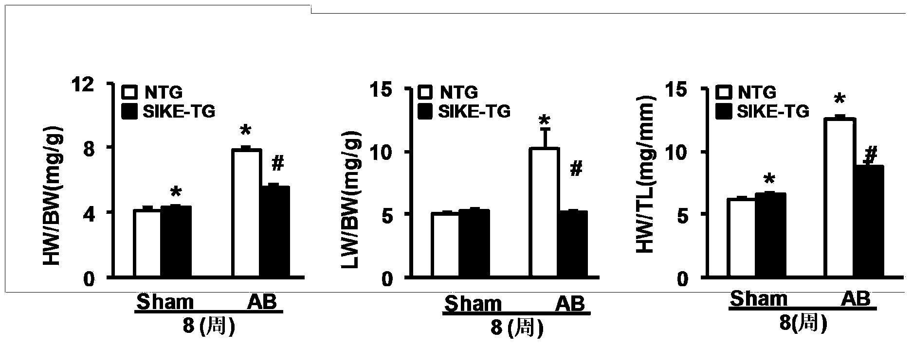 Function and application of IkB kinase epsilon inhibitor (SIKE) in treating cardiac hypertrophy