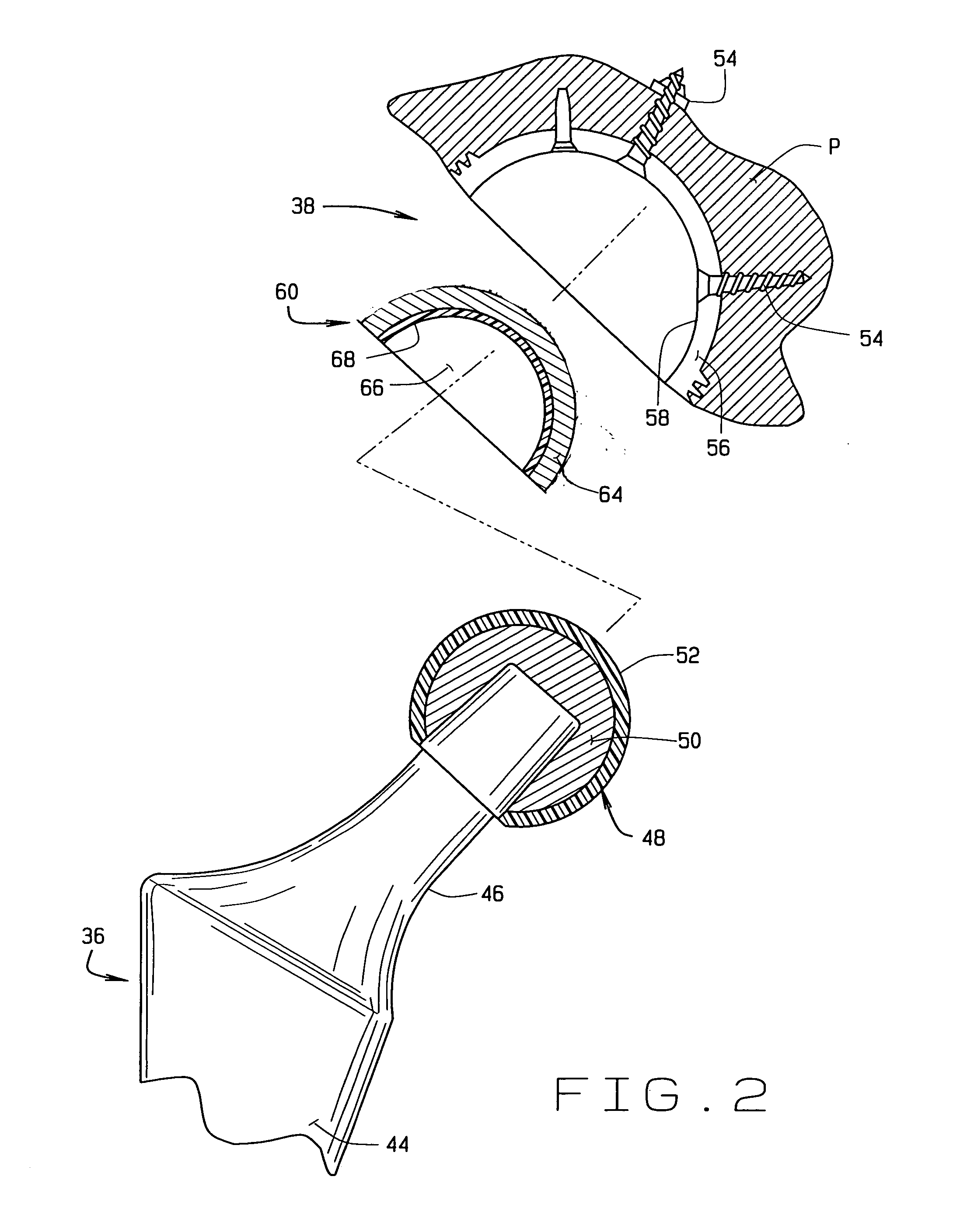 Coated ceramic total joint arthroplasty and method of making same