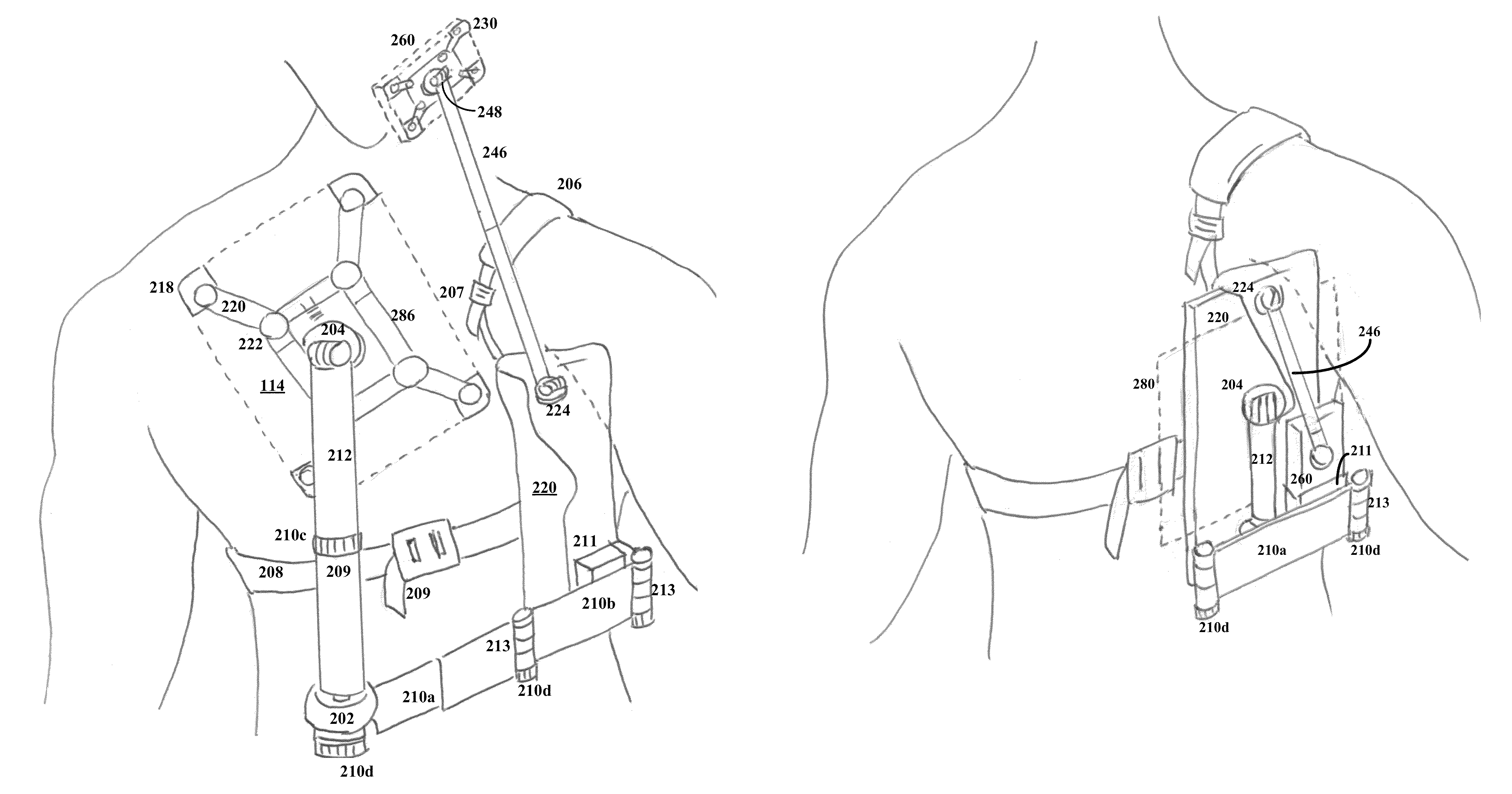 Method and apparatus for attaching a personal electronic device