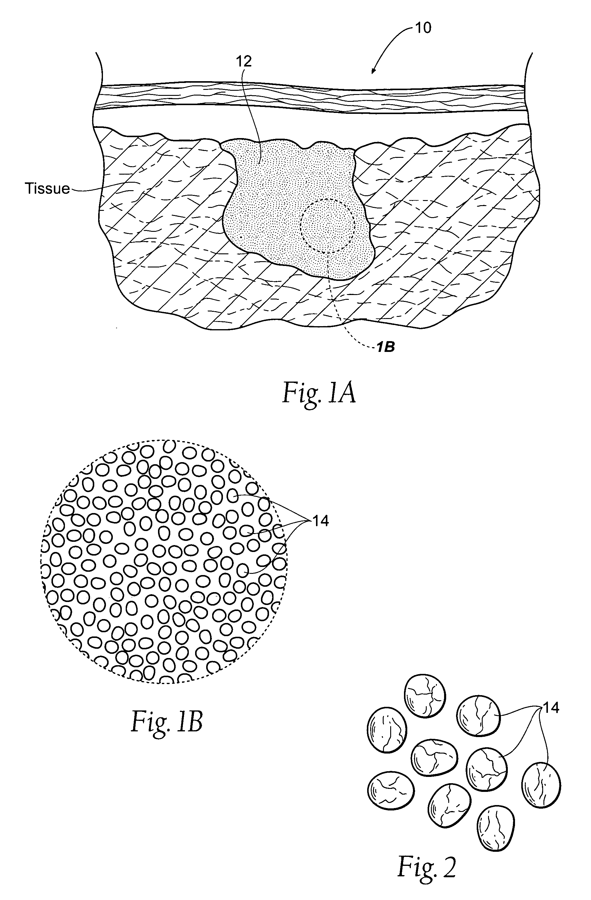 Hemostatic compositions, assemblies, systems, and methods employing particulate hemostatic agents formed from hydrophilic polymer foam such as chitosan
