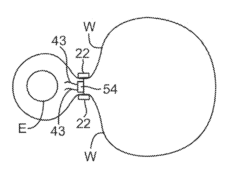 Delivery systems and methods for gastric reduction