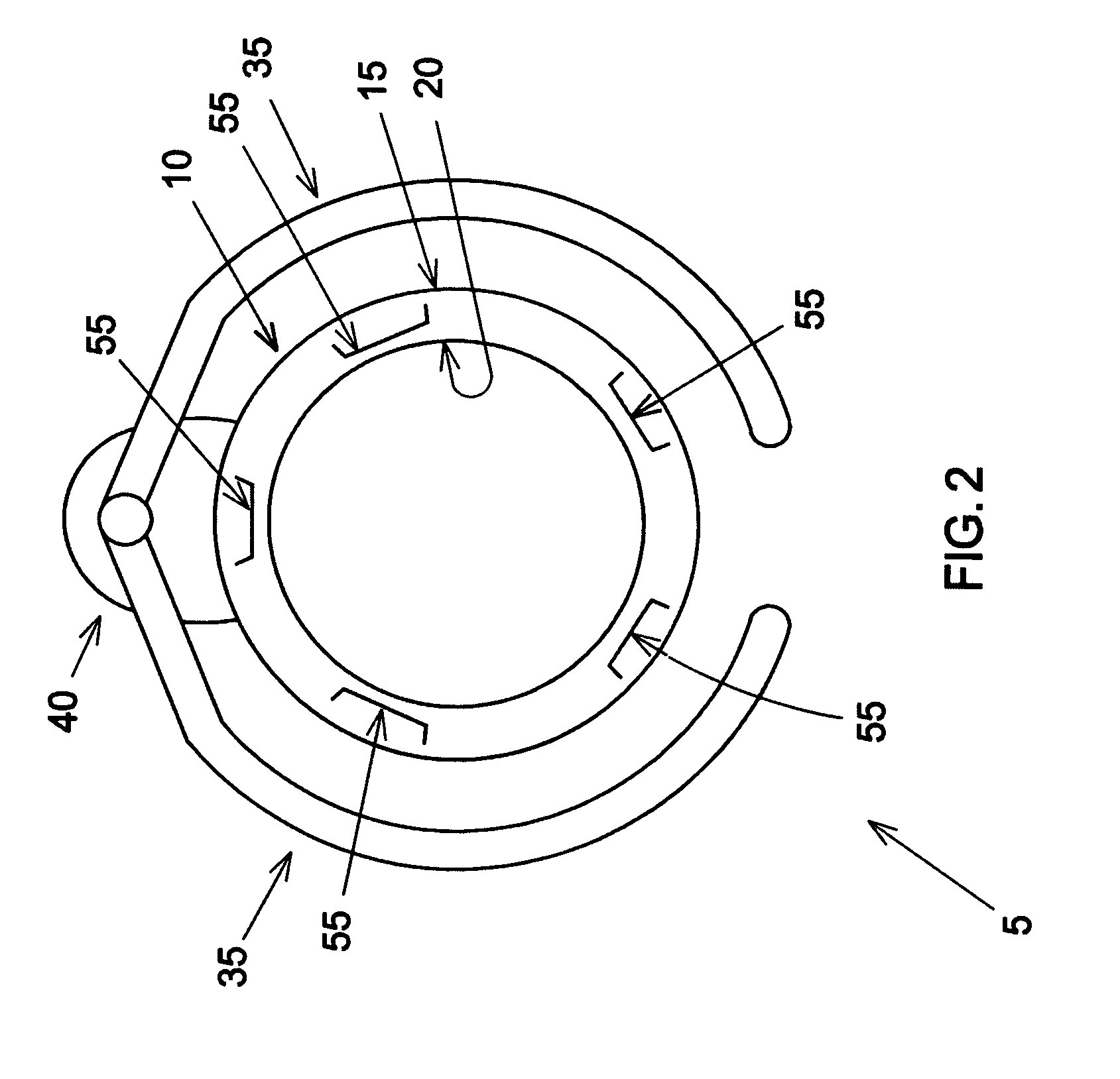 Apparatus and method for manipulating tissue