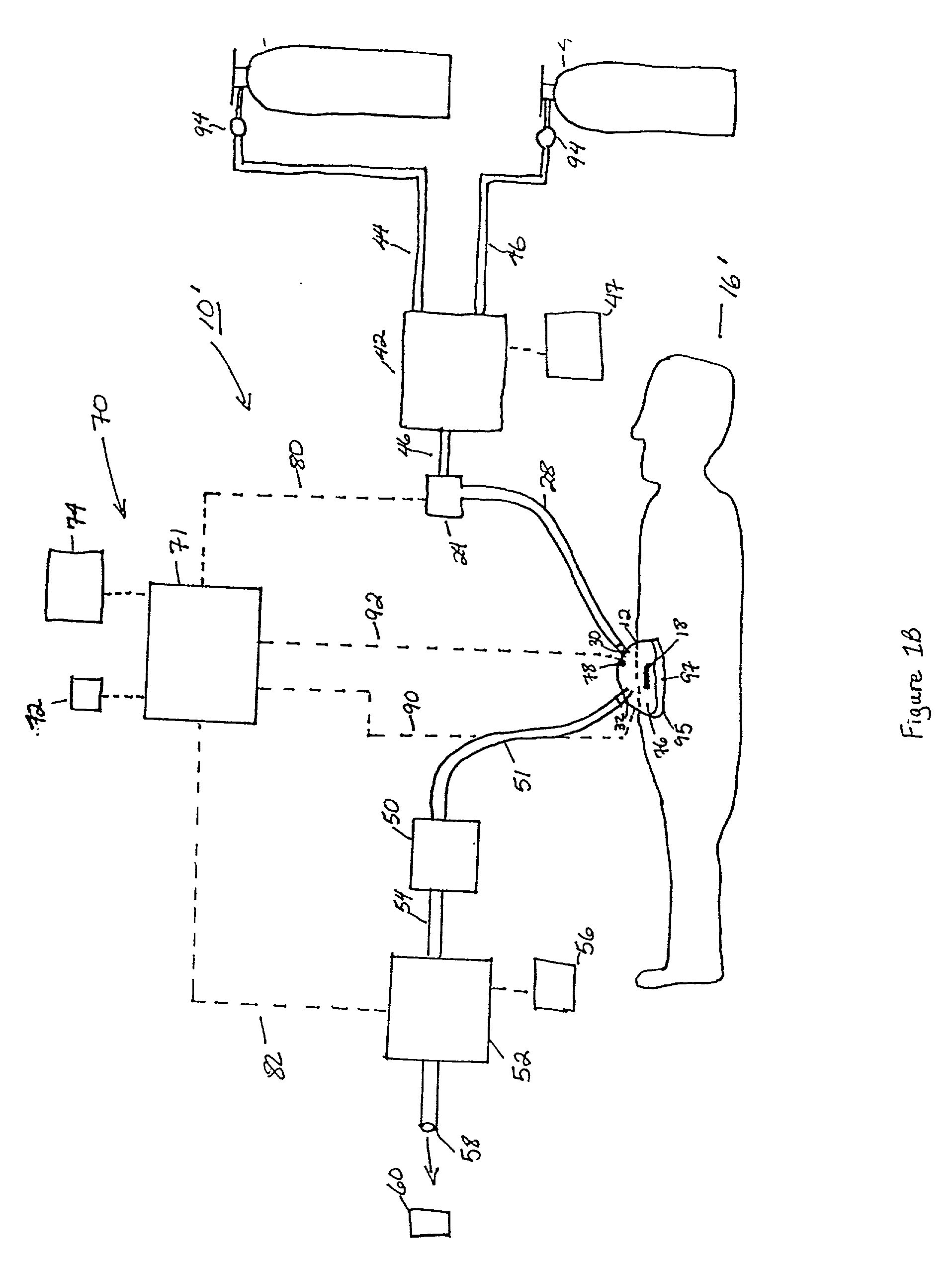 System and method for the prevention of infections in human patients using nitric oxide
