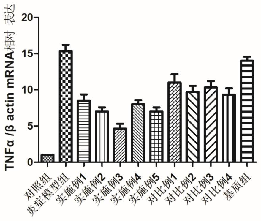 Composition for ophthalmology as well as preparation method and application of composition