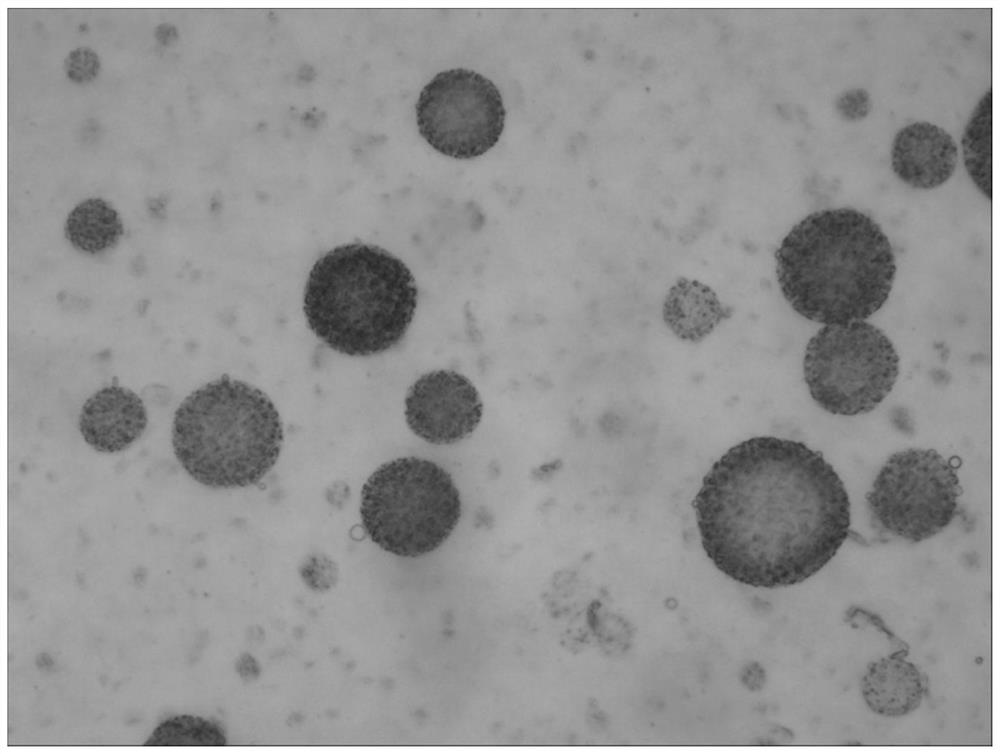 A kind of preparation method of bupivacaine multivesicular liposome and bupivacaine multivesicular liposome preparation