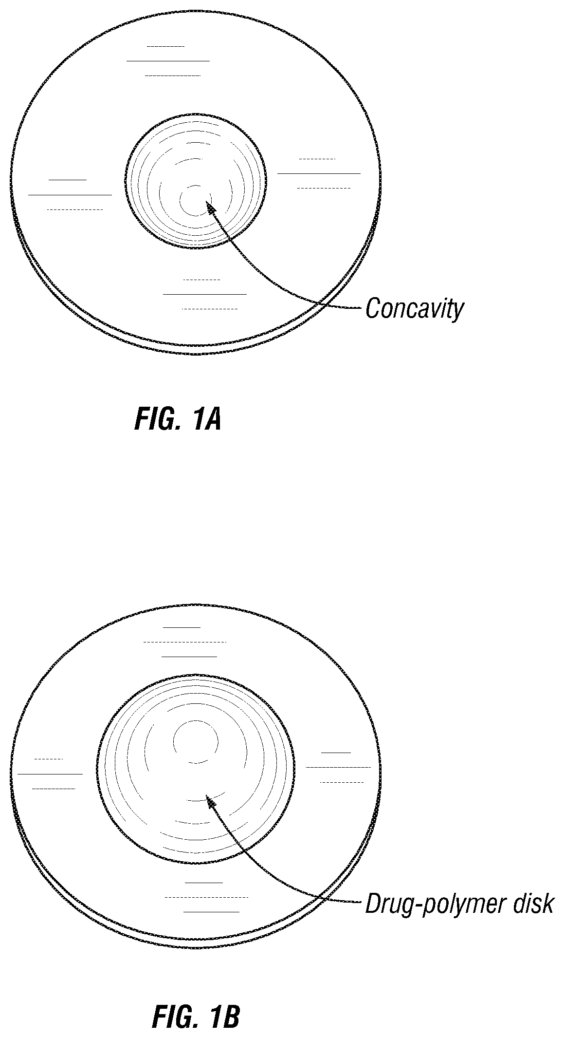 Drug delivery systems and methods for preparation thereof