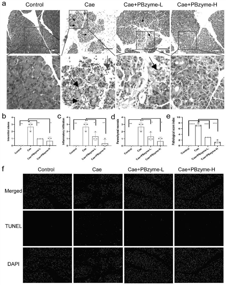 Application of Prussian blue in preparation of medicines for treating acute pancreatitis