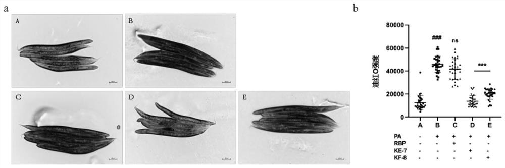 Application of rice bran active peptide in prevention or treatment of lipotoxicity related diseases